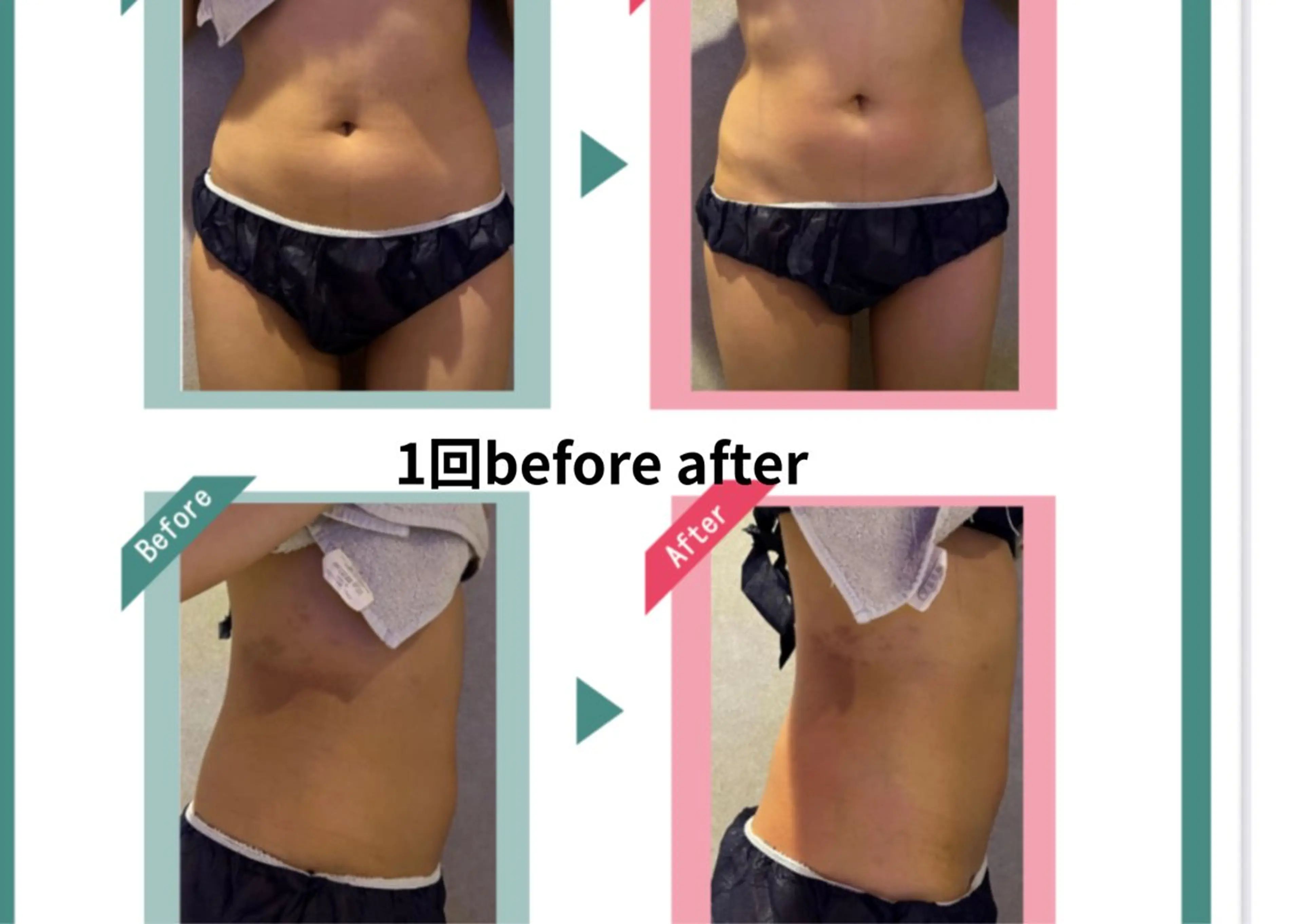 エステ Dahlia痩身脱毛 フェイシャル 中村のエステ・リラクイメージ