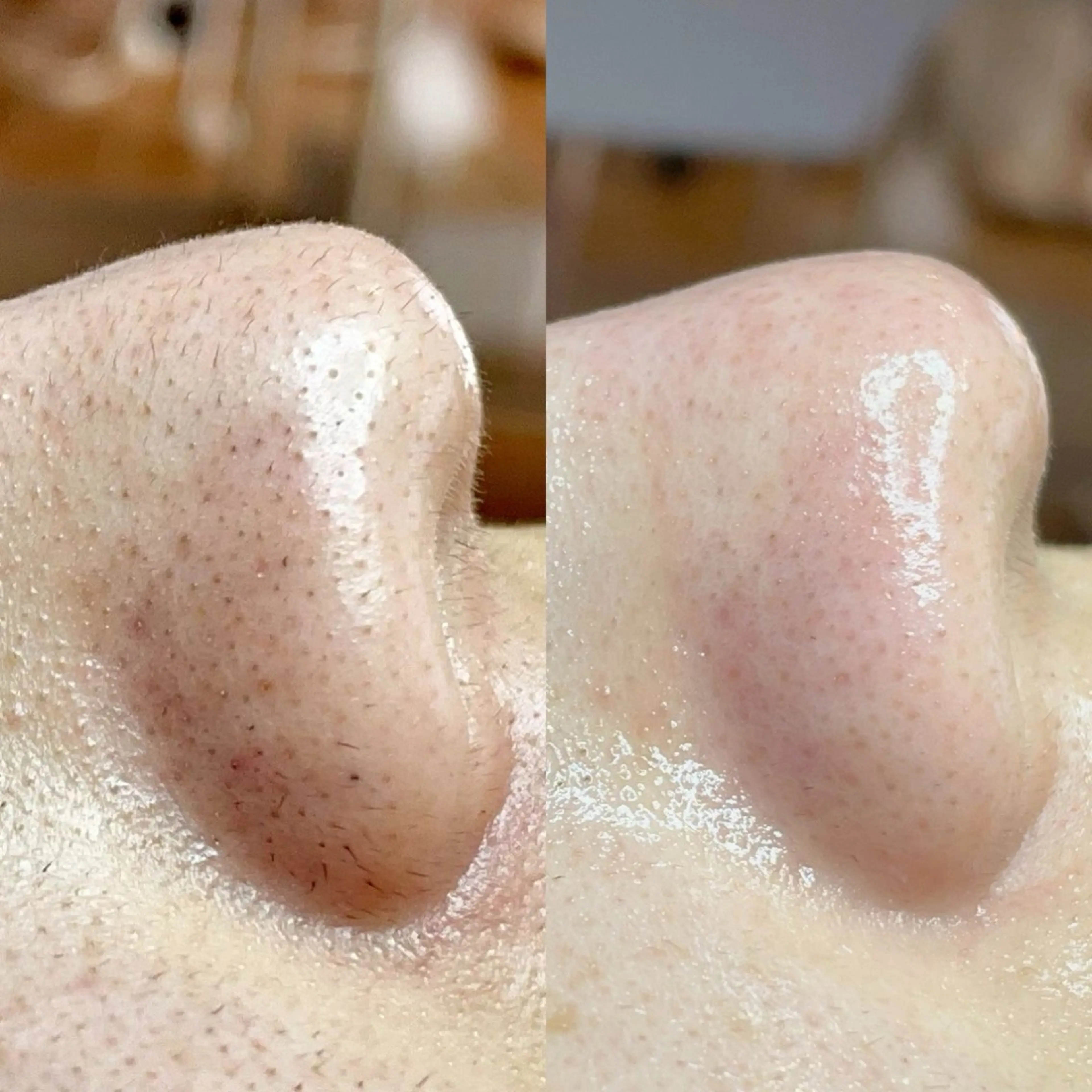 毛穴・頭皮 専門店💪のその他イメージ