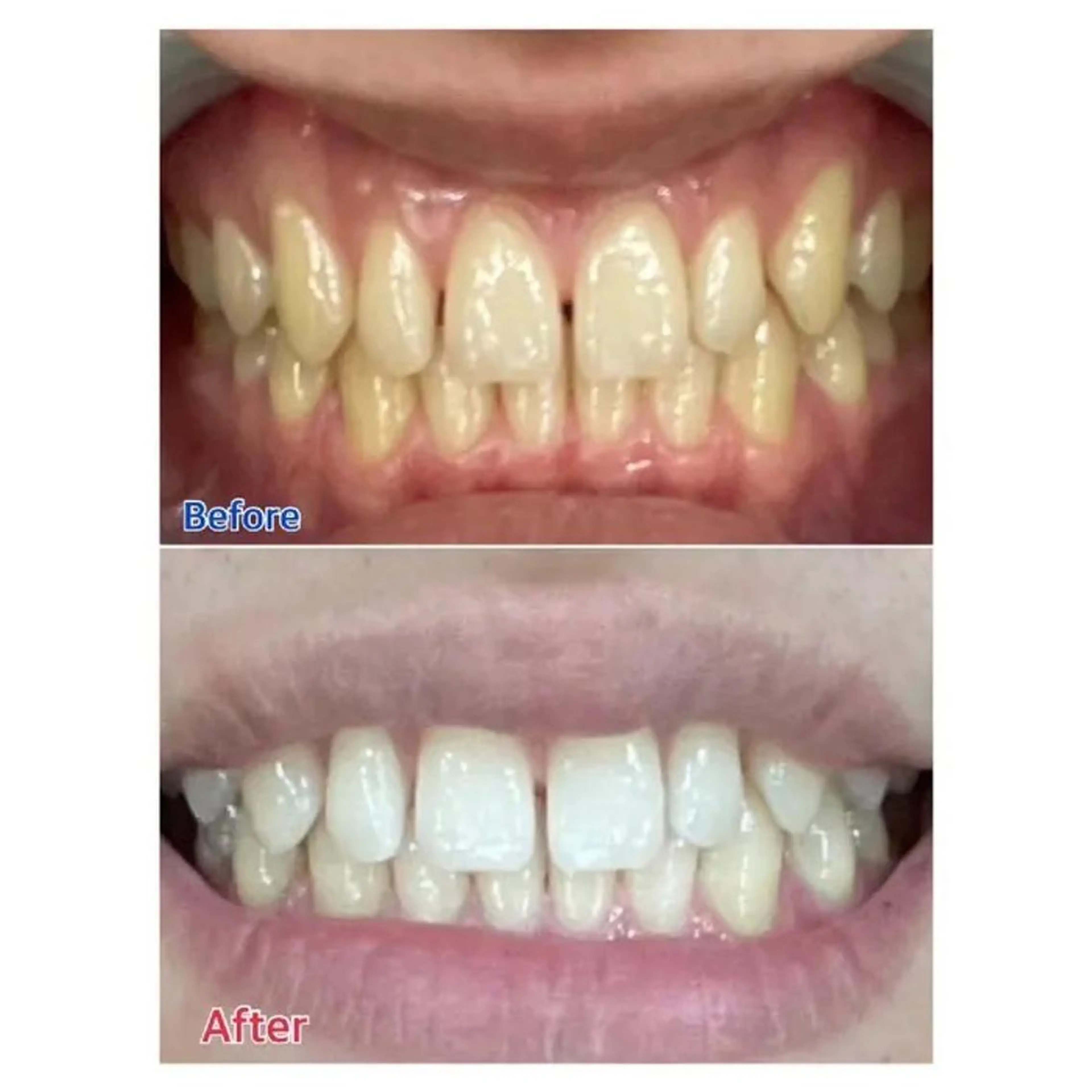 M渋谷 ホワイトニングのその他イメージ