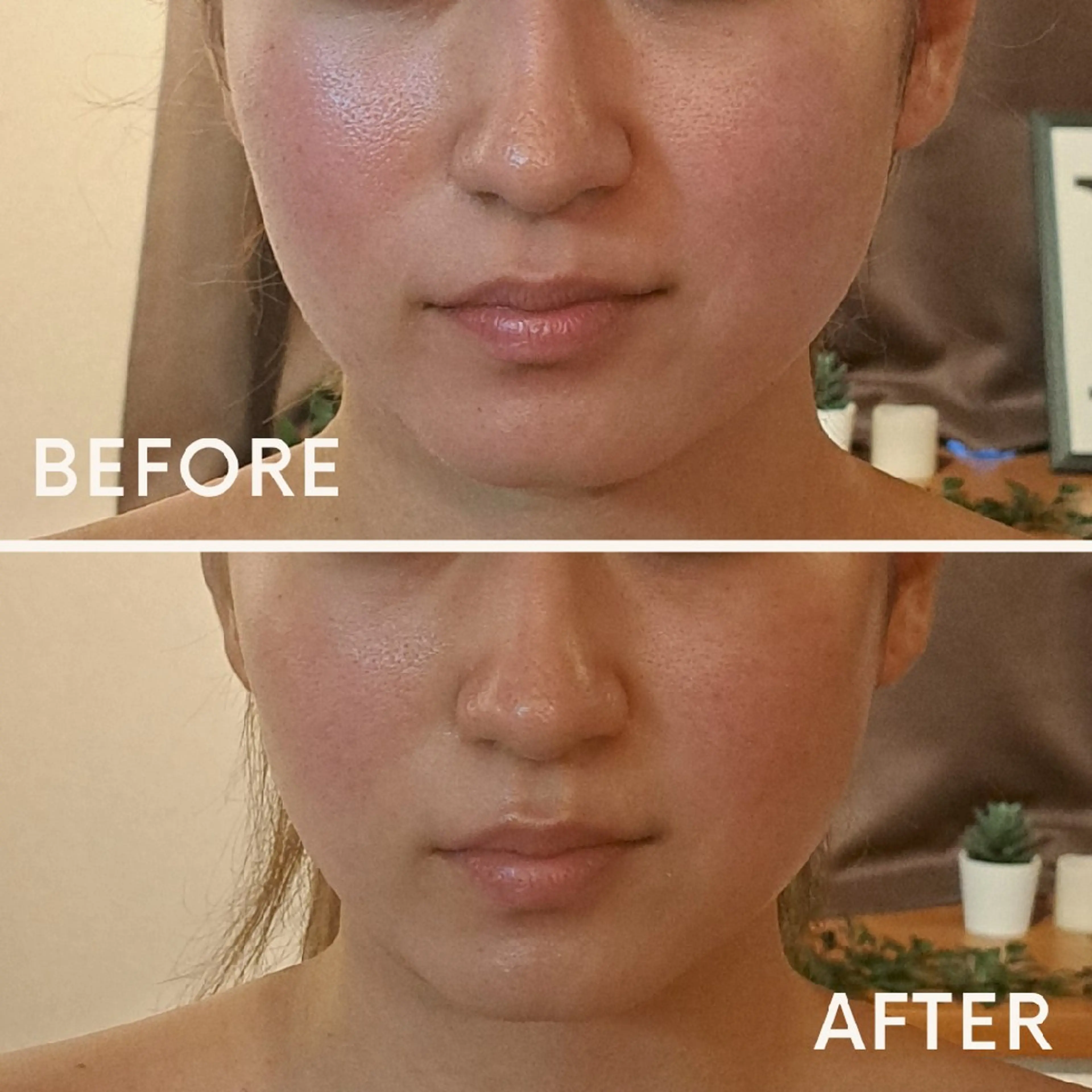 鍼灸サロンmiyabi所属・美容鍼×エステ　鍼灸 サロンmiyabiのエステ・リラクイメージ