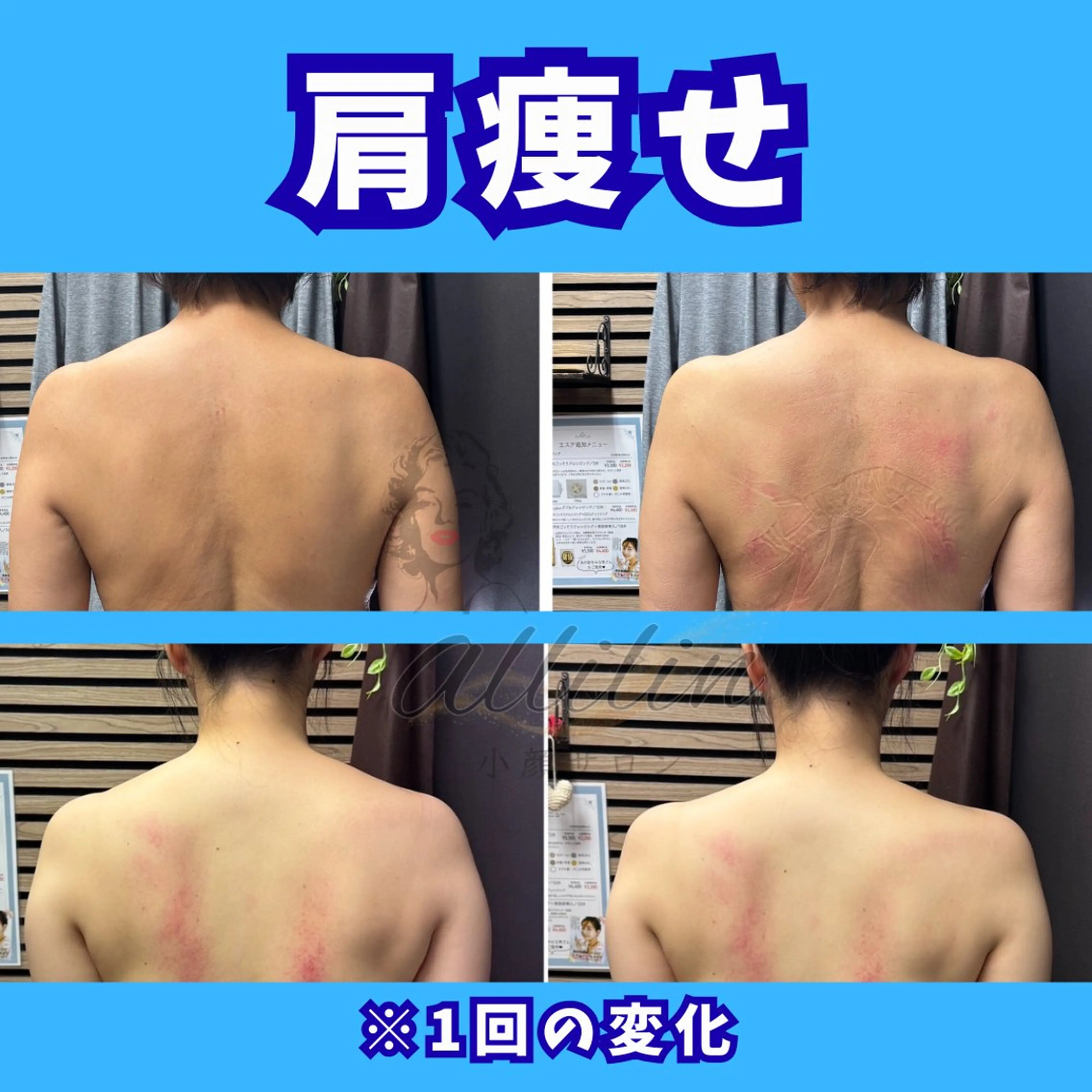 💎小顔ｻﾛﾝ アリリン銀座💎のエステ・リラクイメージ