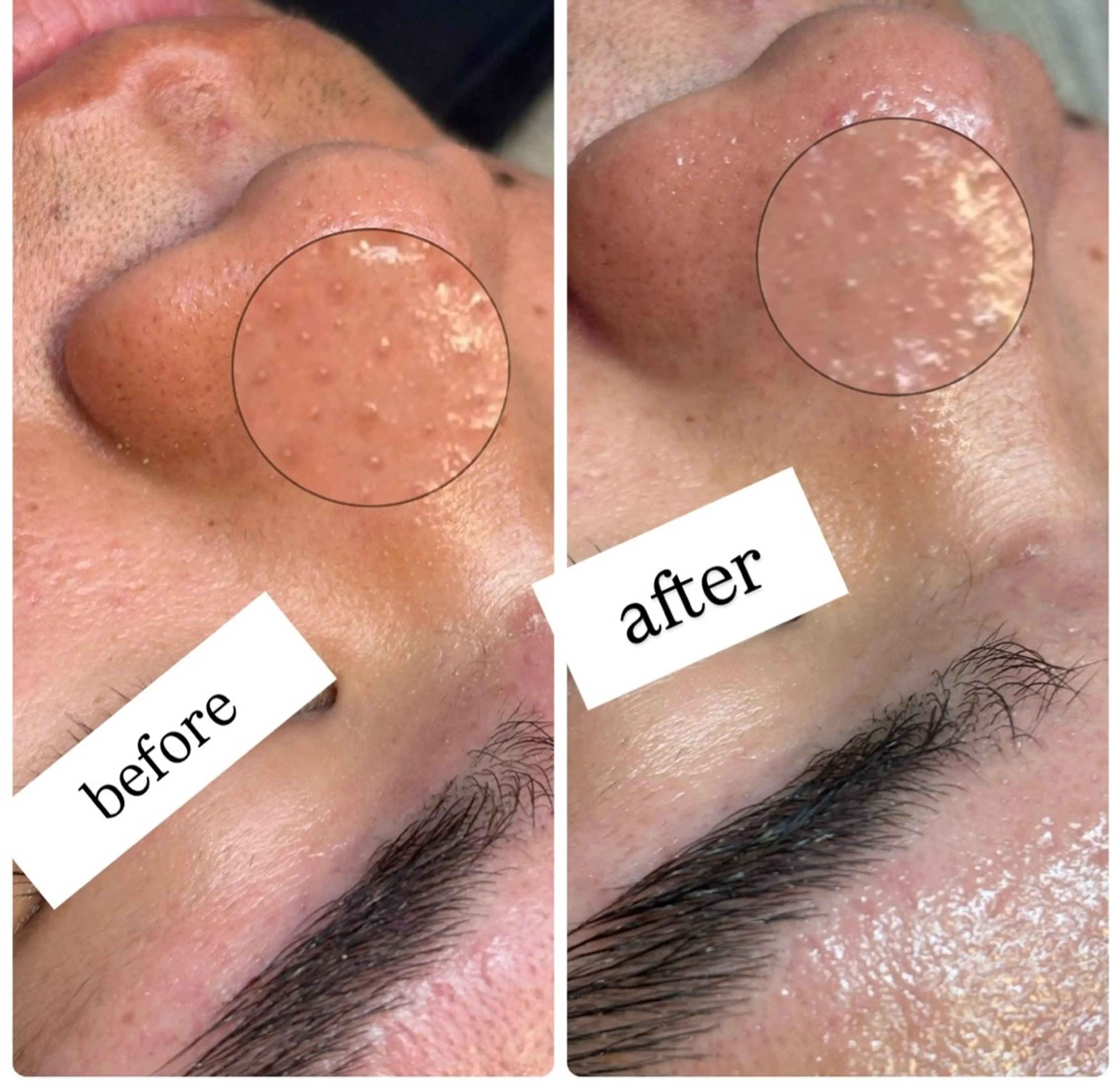 ワックス脱毛 🌿肌管理×美眉 yuzu.の眉毛・アイブロウイメージ