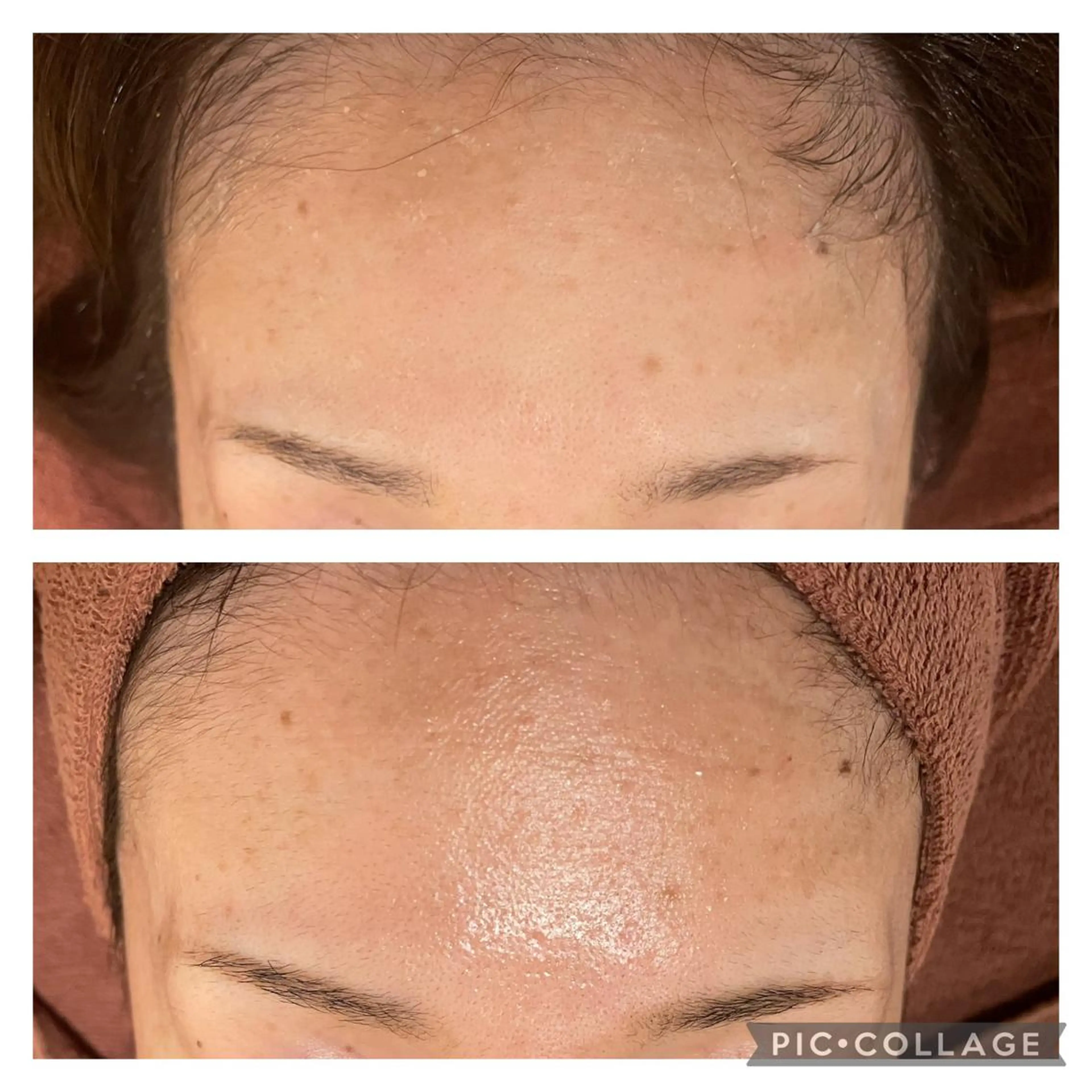 ロング カラー パーマ ヘアアレンジ メンズ キッズ ネイル マツエク・マツパ アイブロウ エステ リラク ニキビ特化型エステ 🍋最短で肌質改善のエステ・リラクイメージ