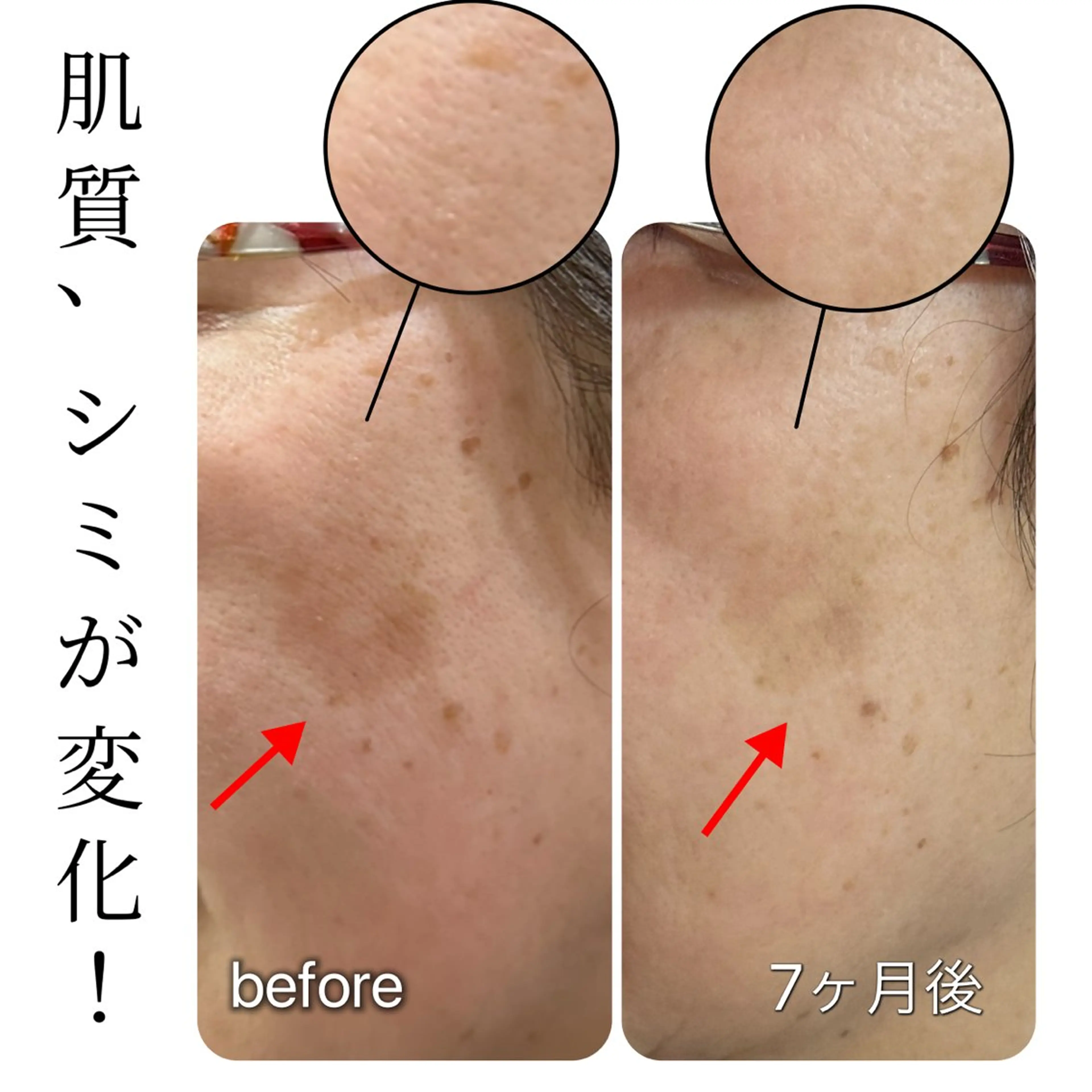 その他 堀 和恵の眉毛・アイブロウイメージ