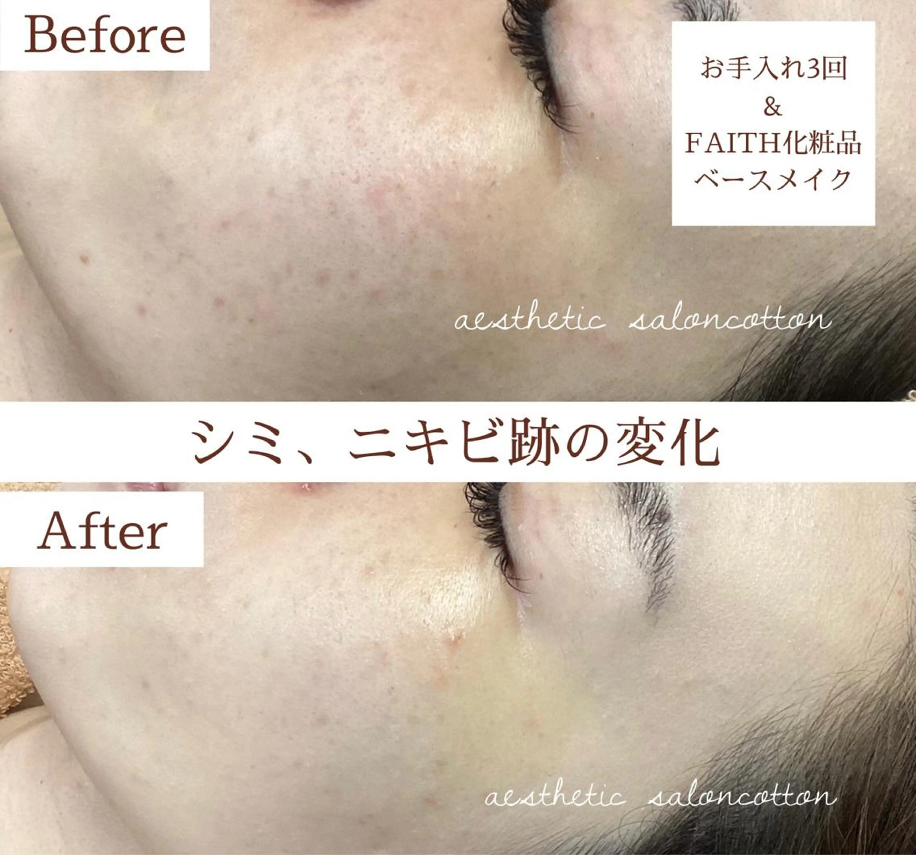 エステ 都度払い 肌質改善専門サロンのエステ・リラクイメージ