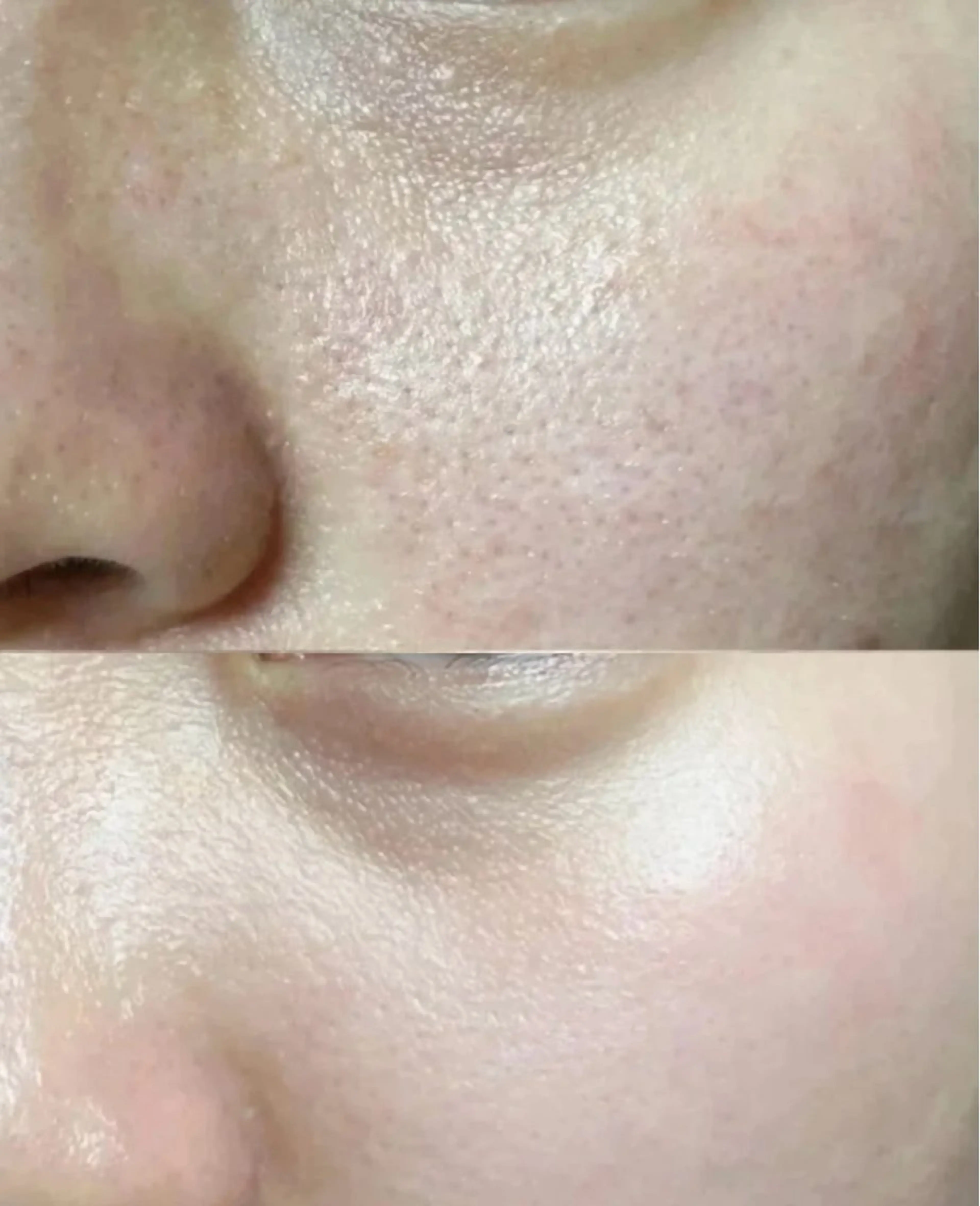 ショート エステ aliaハーブ水光店 エステティシャン募集のエステ・リラクイメージ