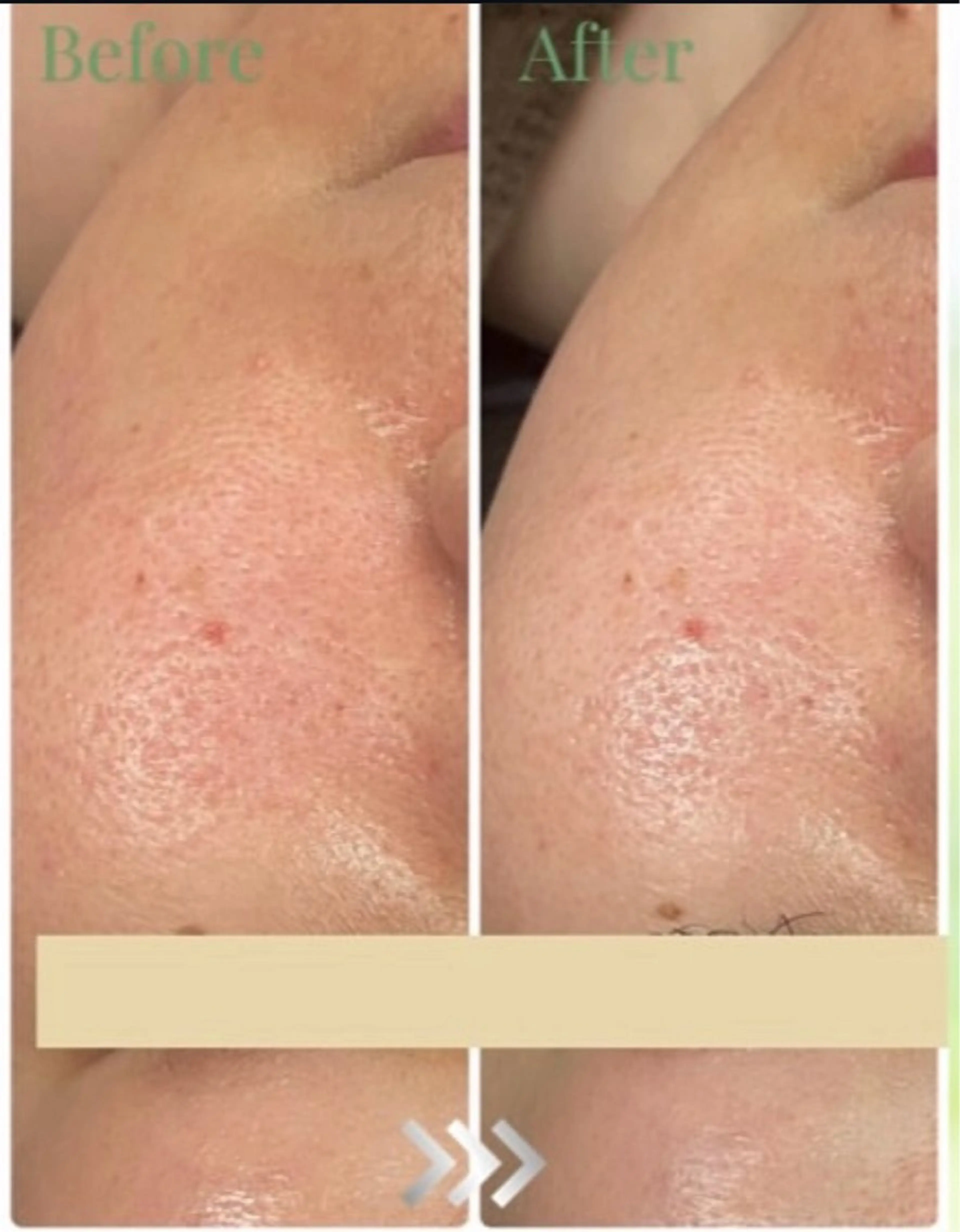 bonuru salonのエステ・リラクイメージ