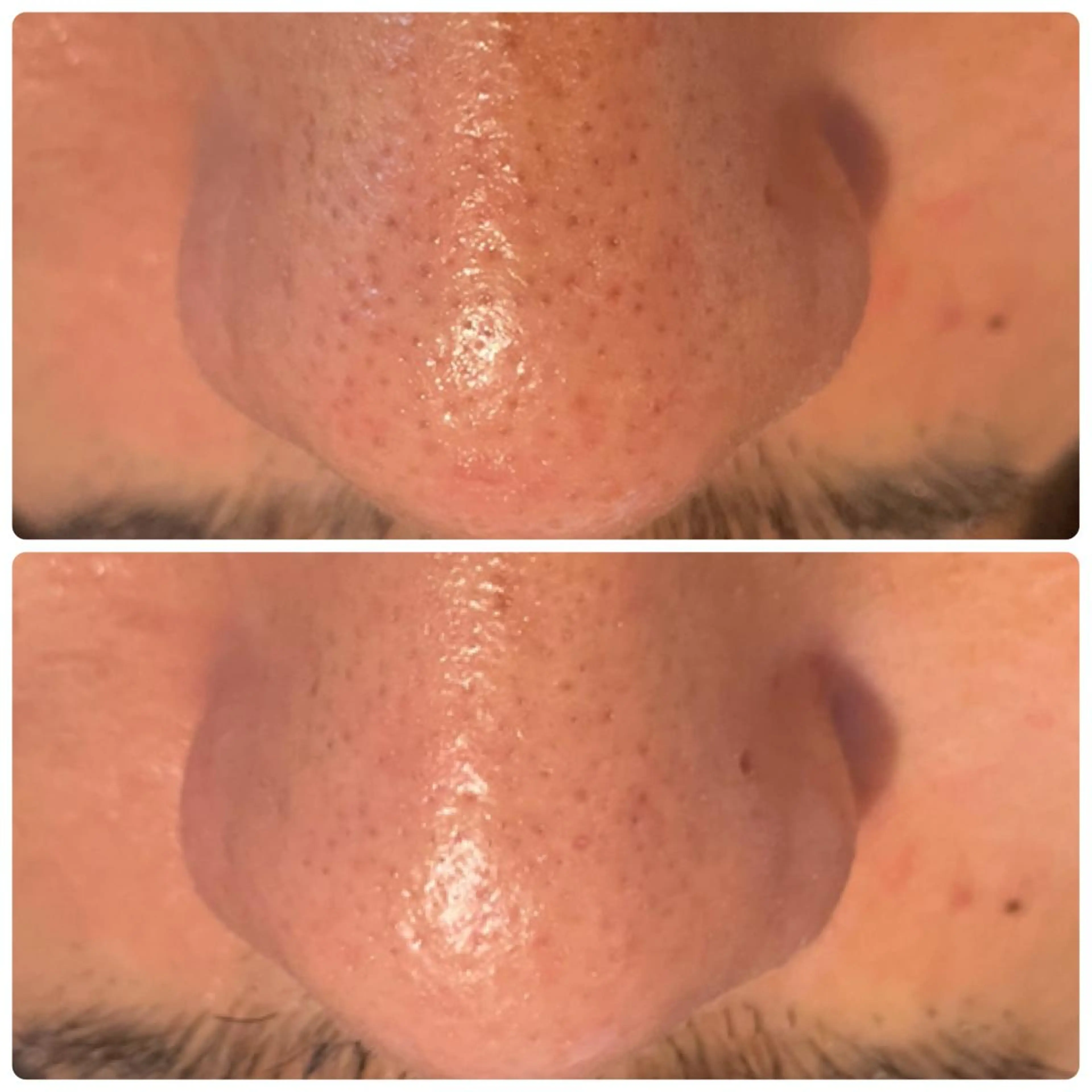 メンズ Mignon + Natsukiのマツエク・マツパデザイン