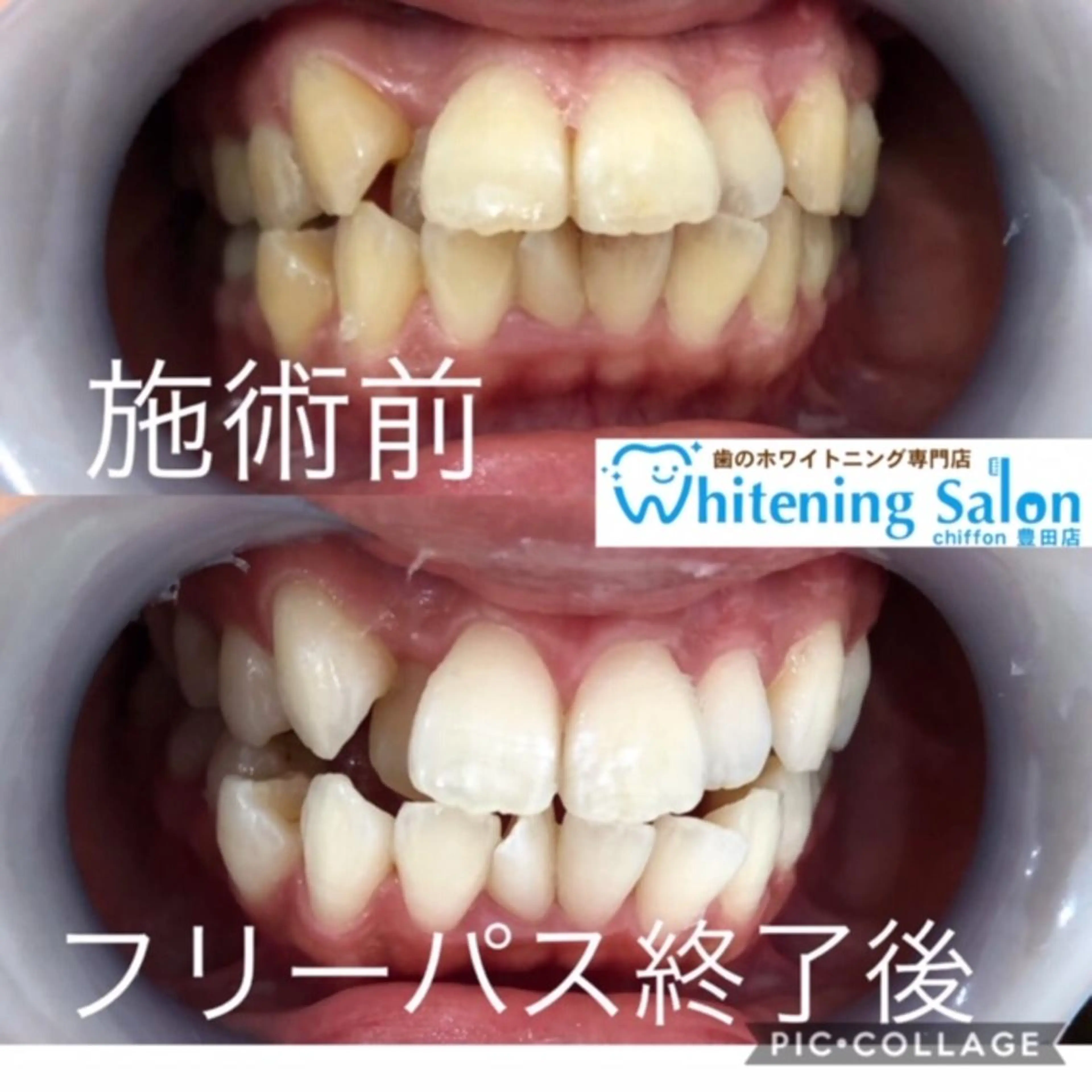 歯科レベルの白さ💎 ✨ホワイトニング豊田のエステ・リラクイメージ