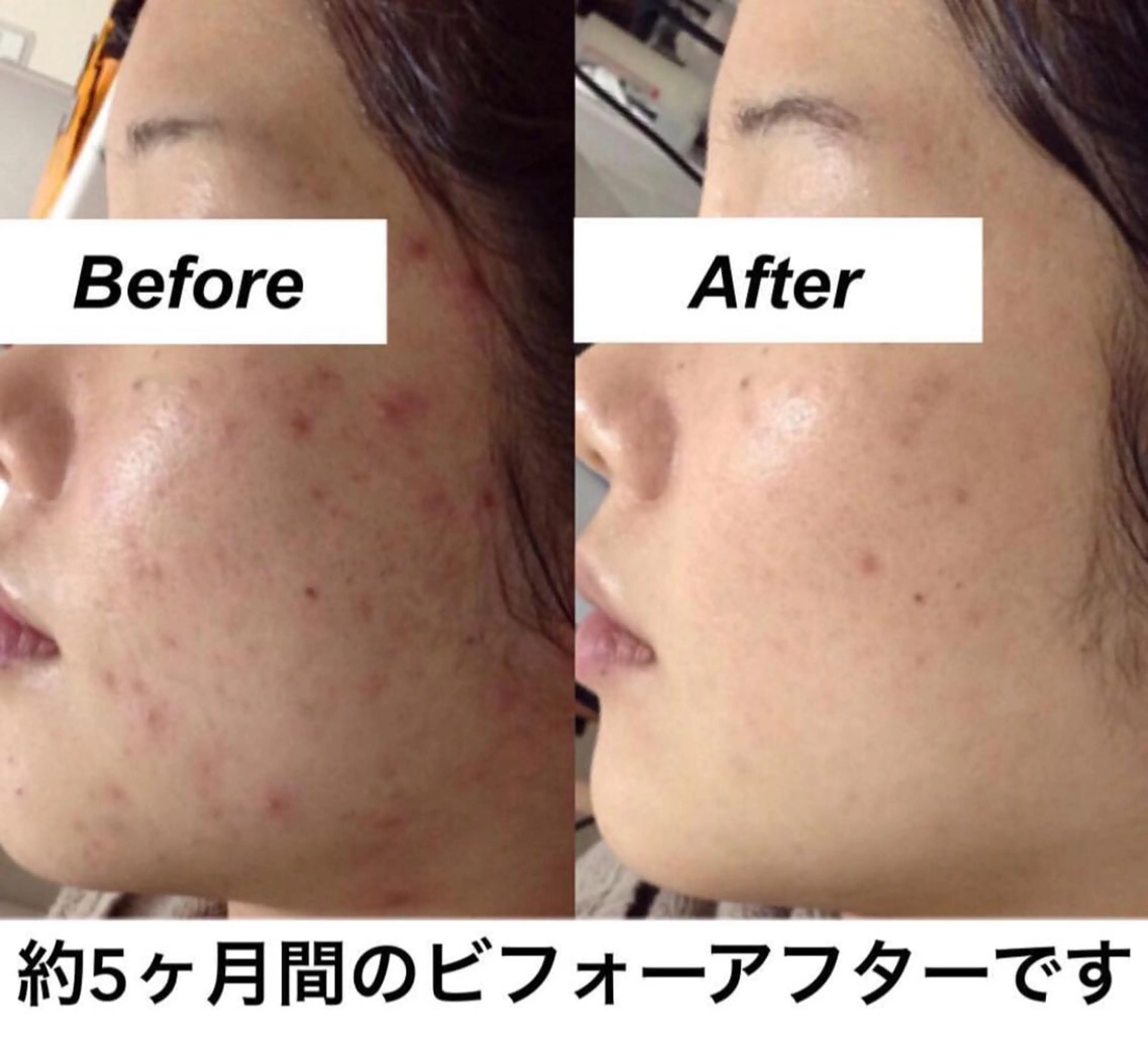 エステ リラク 都度払い肌質改善 &脱毛Blancheのエステ・リラクイメージ