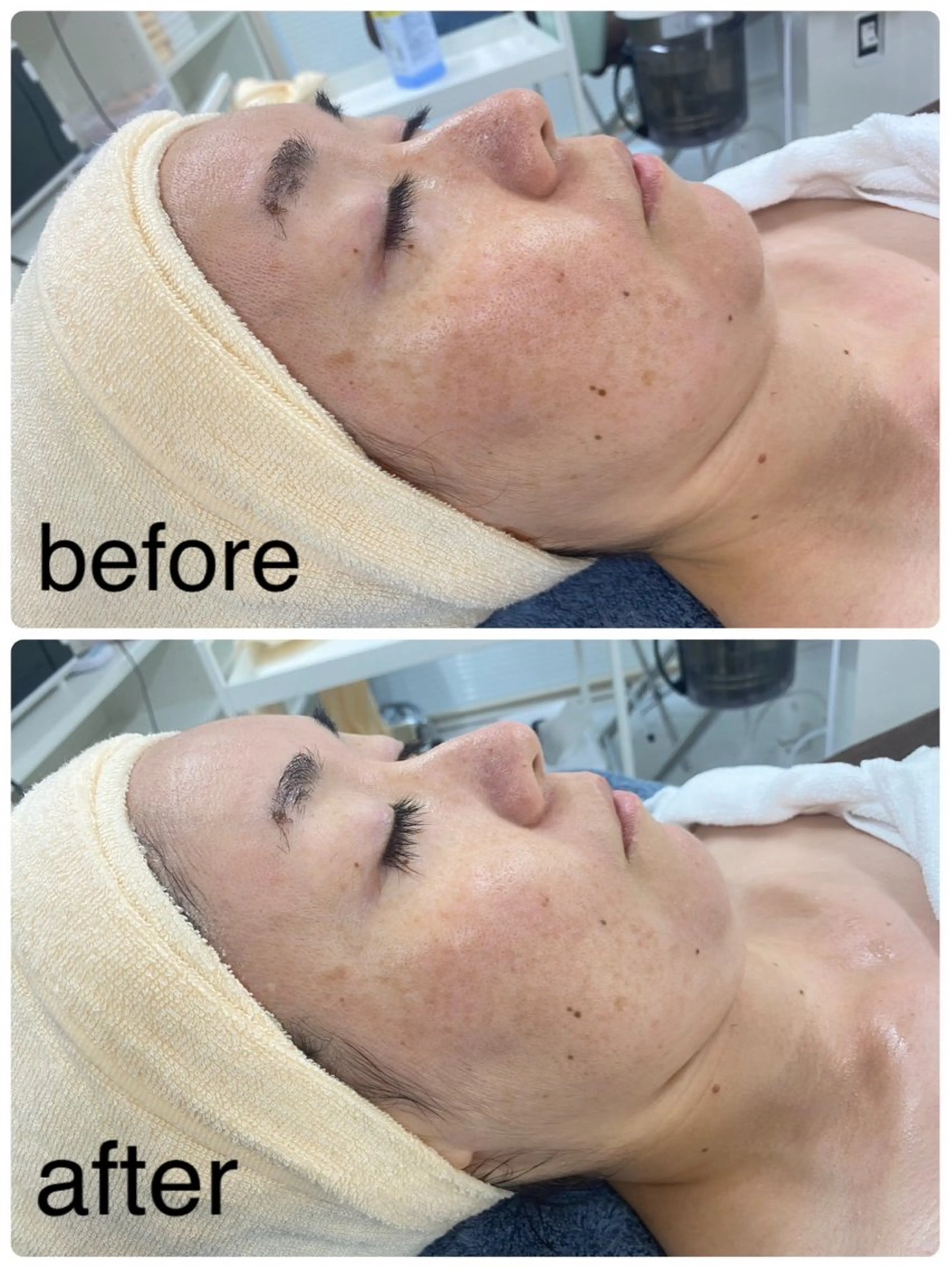 Toujours トゥジュールのエステ・リラクイメージ