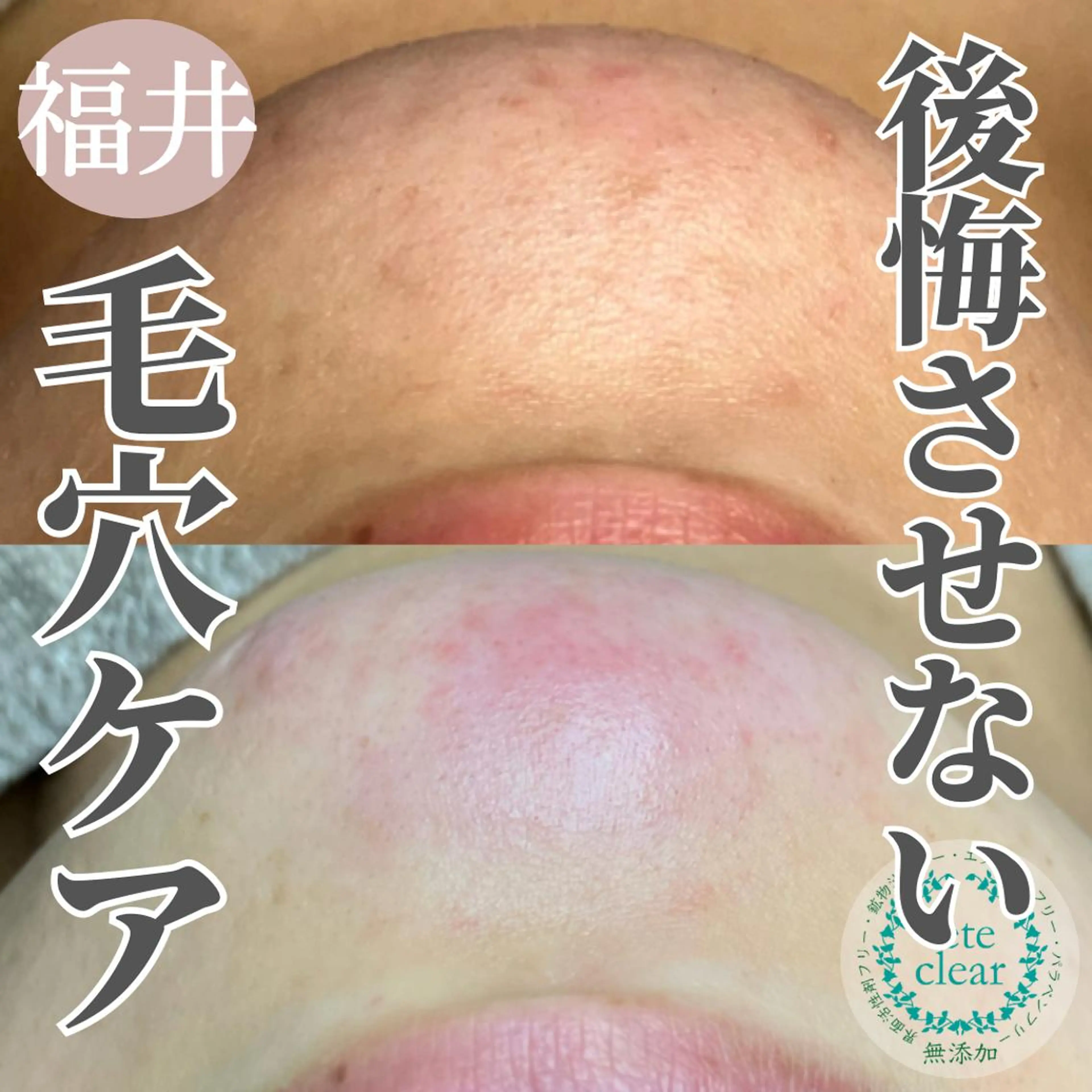 毛穴肌質ケアサロン Yourmeユアミーのエステ・リラクイメージ