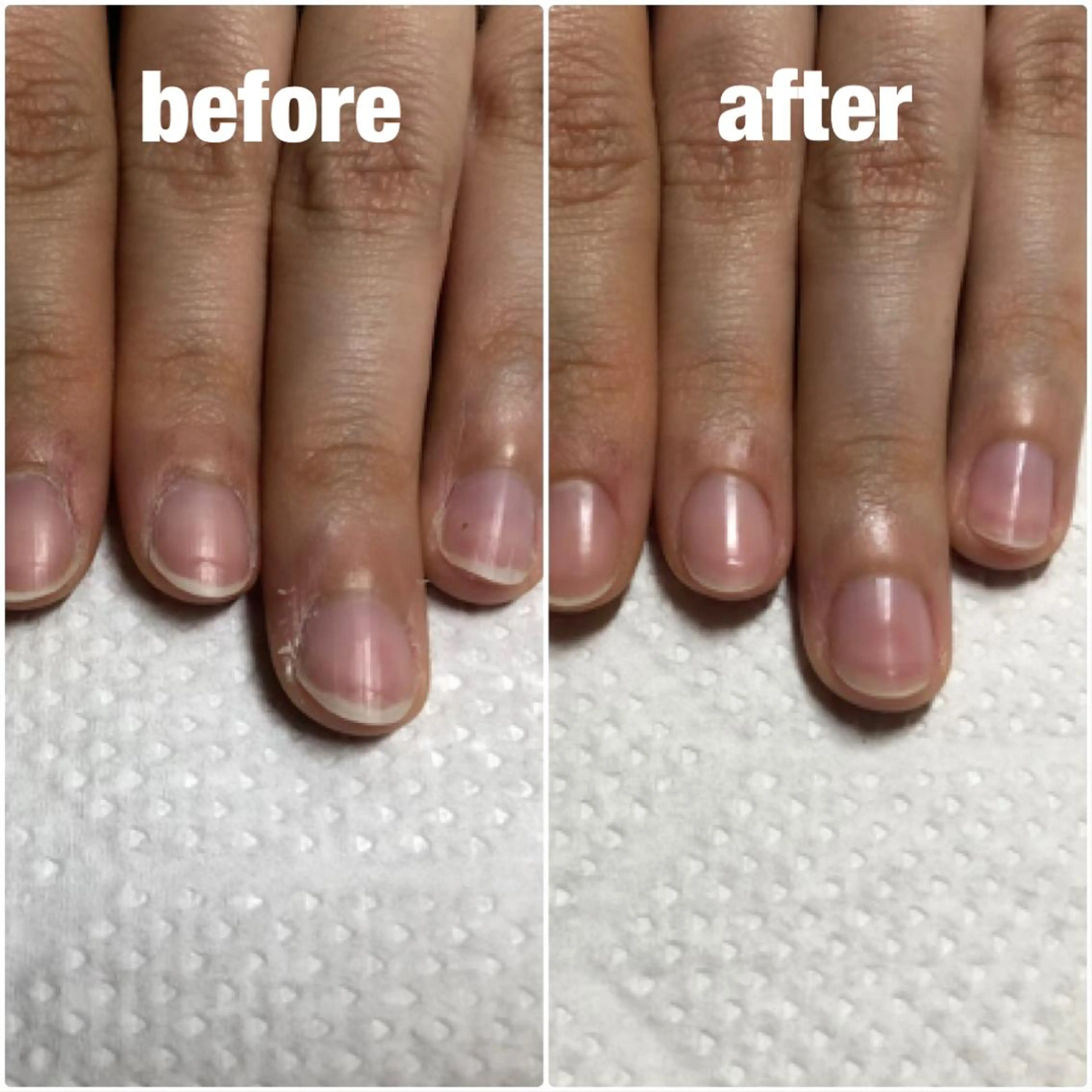 ネイル kichi・: *のネイルデザイン