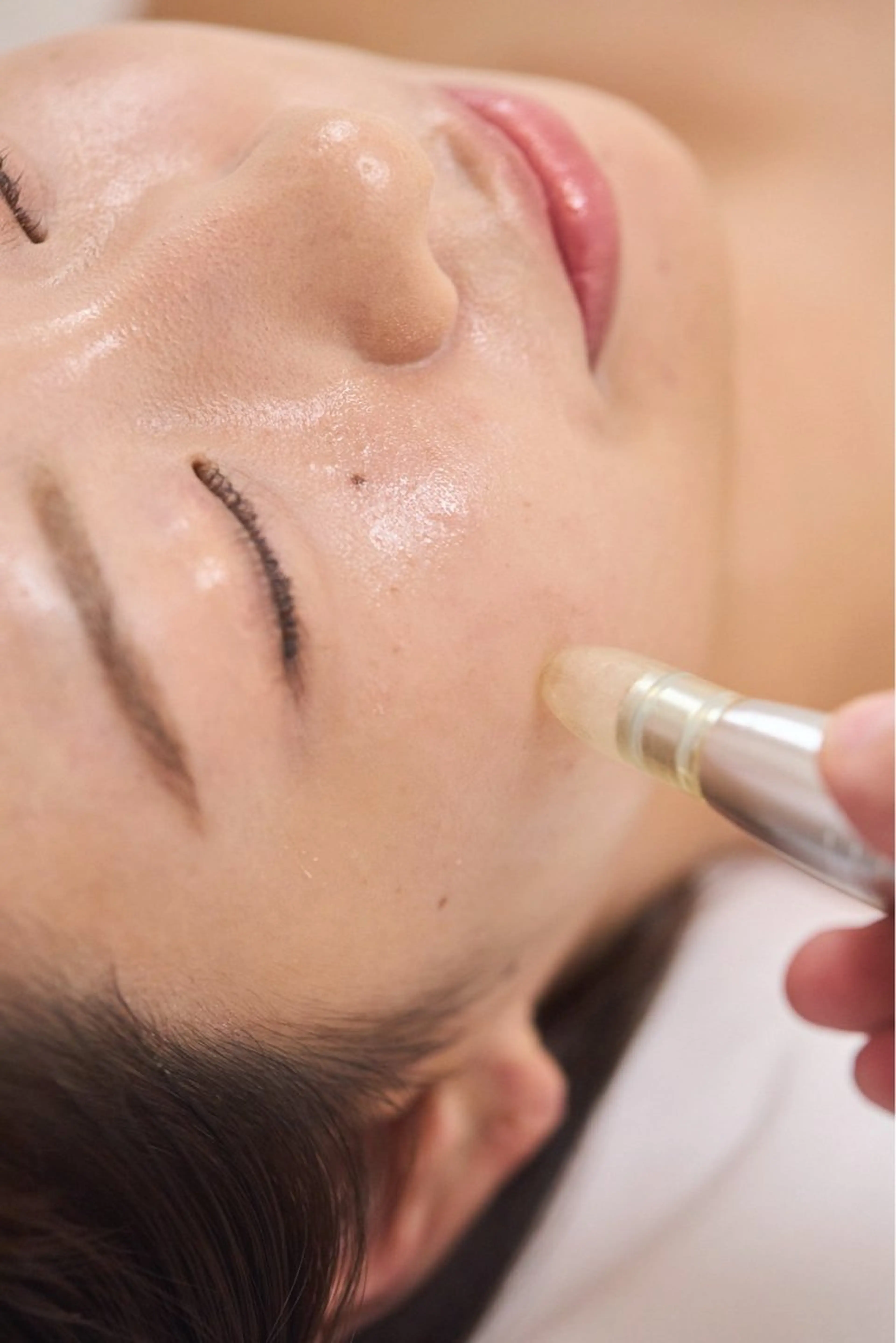 ニキビ専門サロンoliss新宿店所属・ニキビ専門サロン oliss新宿店のエステ・リラクイメージ