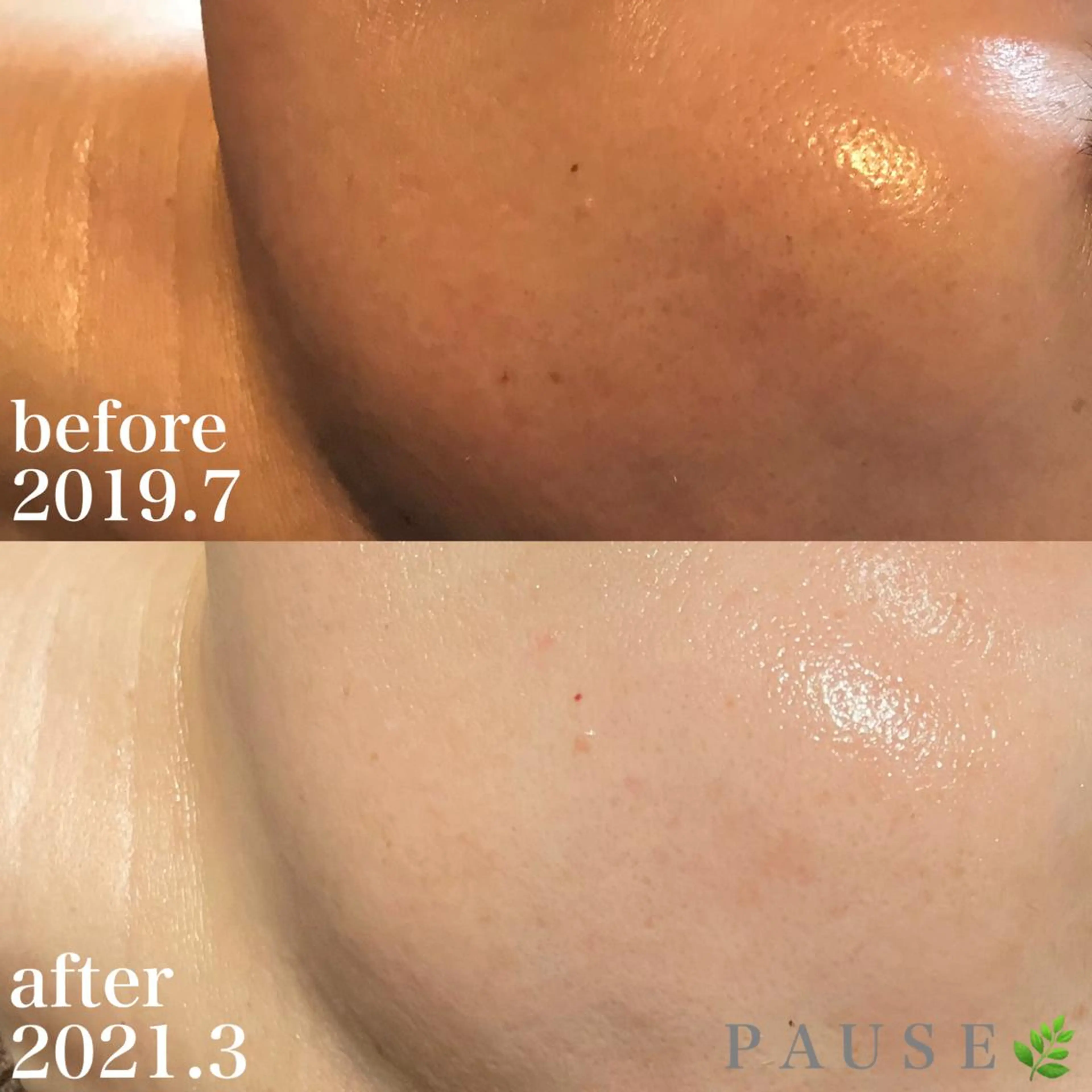 エステ 浜野 恵美のエステ・リラクイメージ