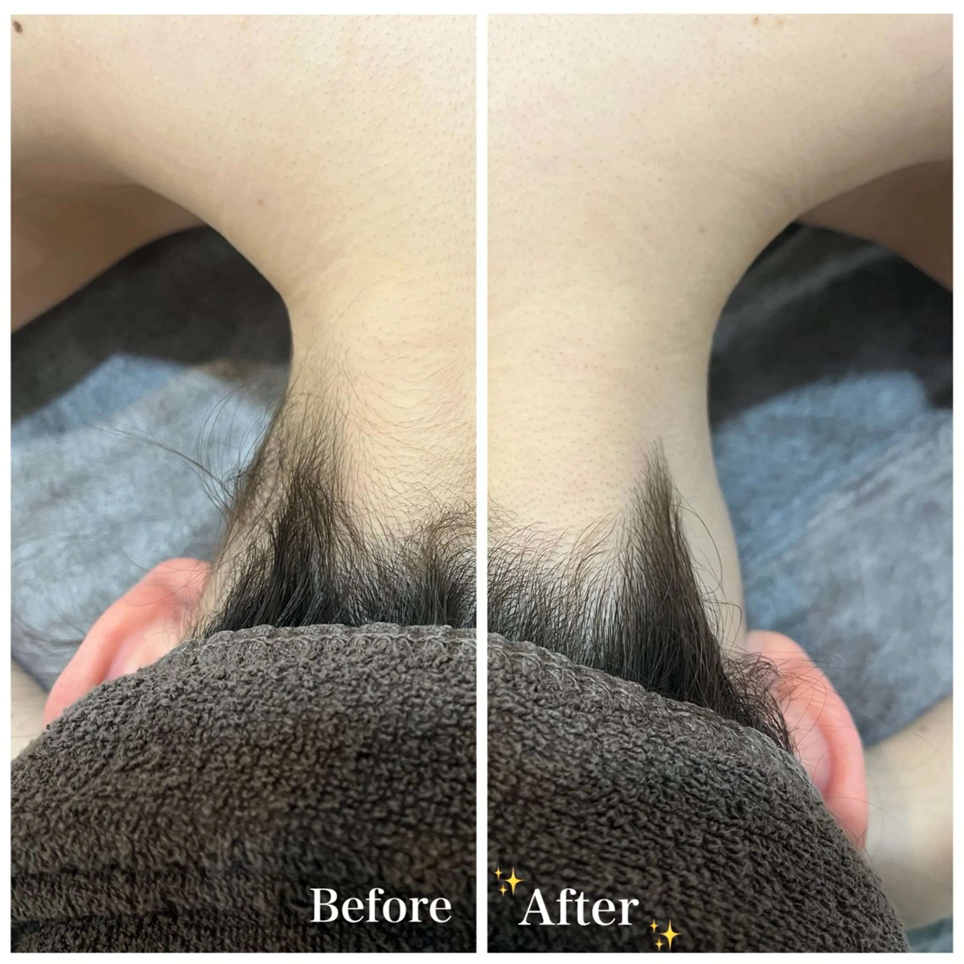 脱毛 脱毛サロン fam.豊澤柚良のエステ・リラクイメージ