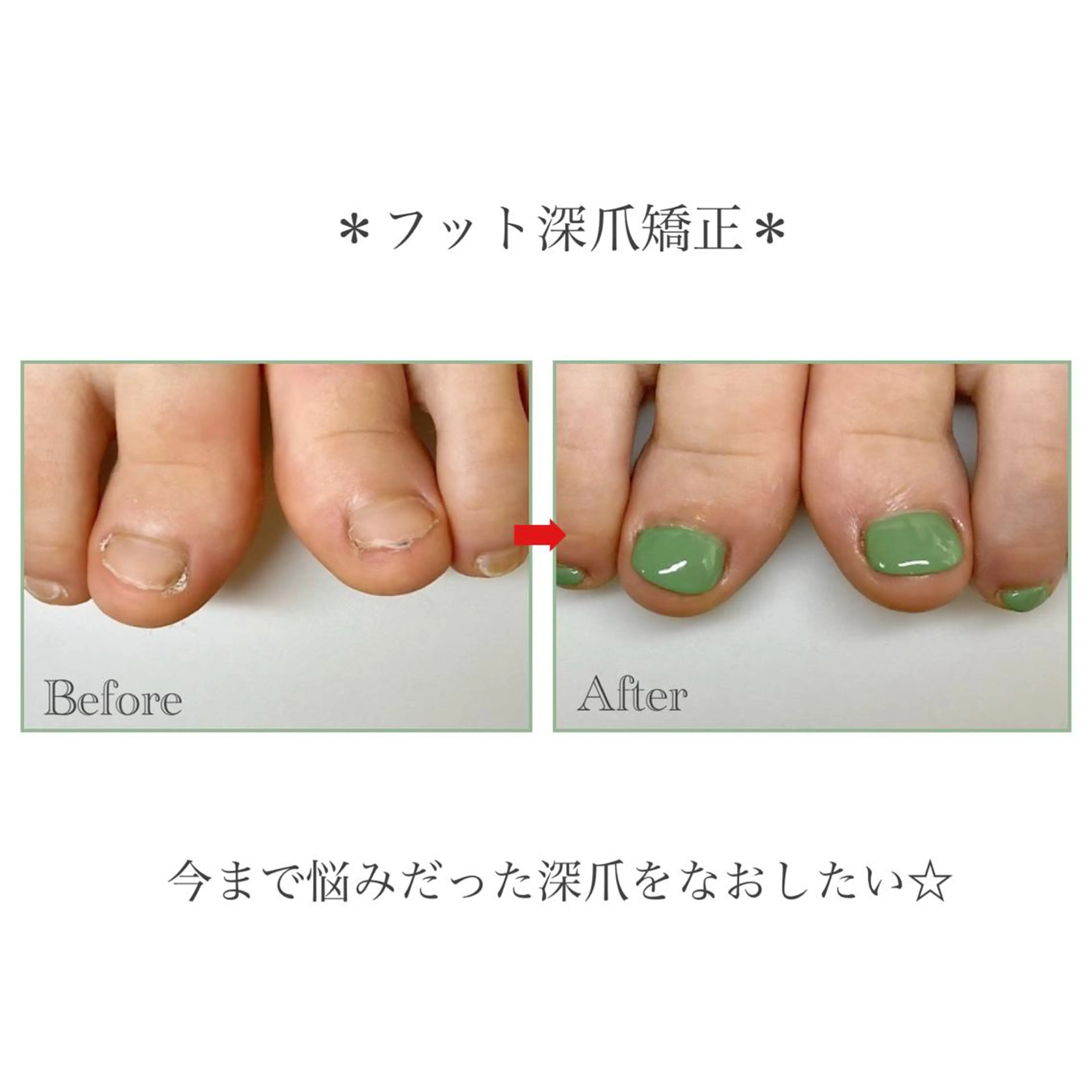 ネイル フットネイル ネイルサロン アリュームのネイルデザイン