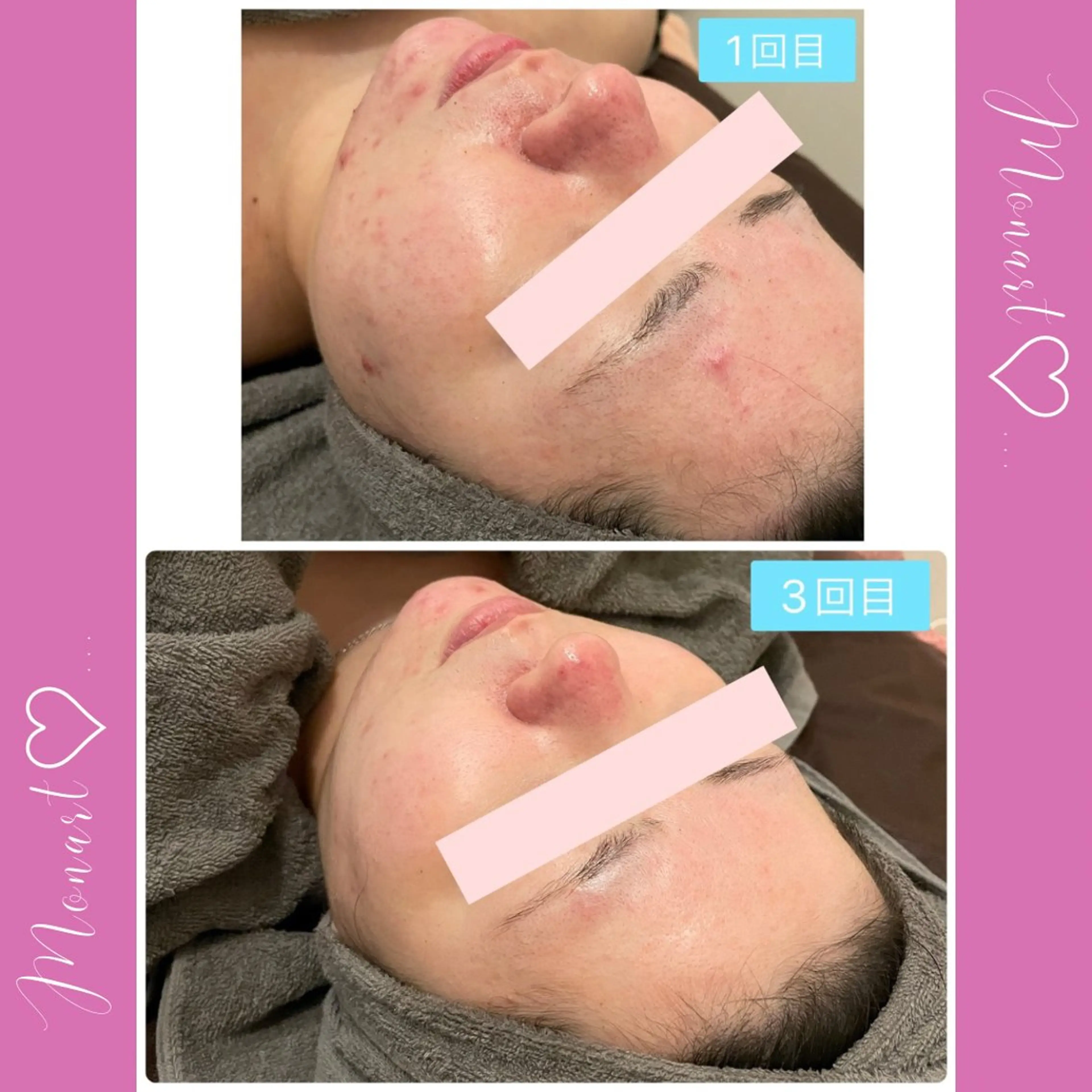 Monart -deux-のエステ・リラクイメージ