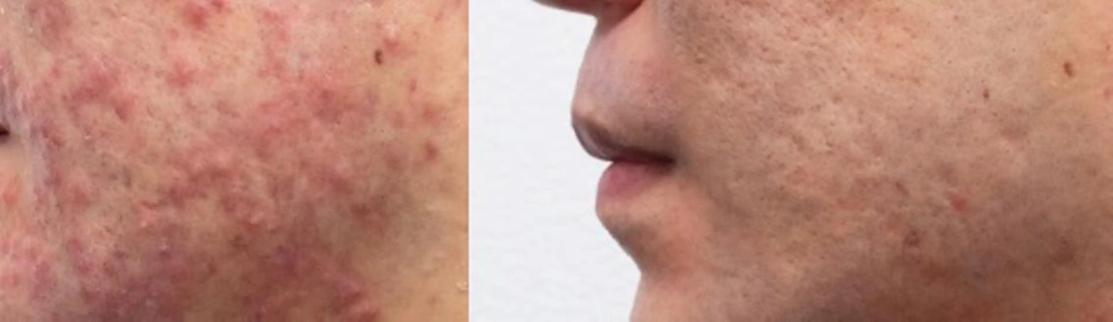 メンズ 朝重い人専用 肩甲骨調整のエステ・リラクイメージ