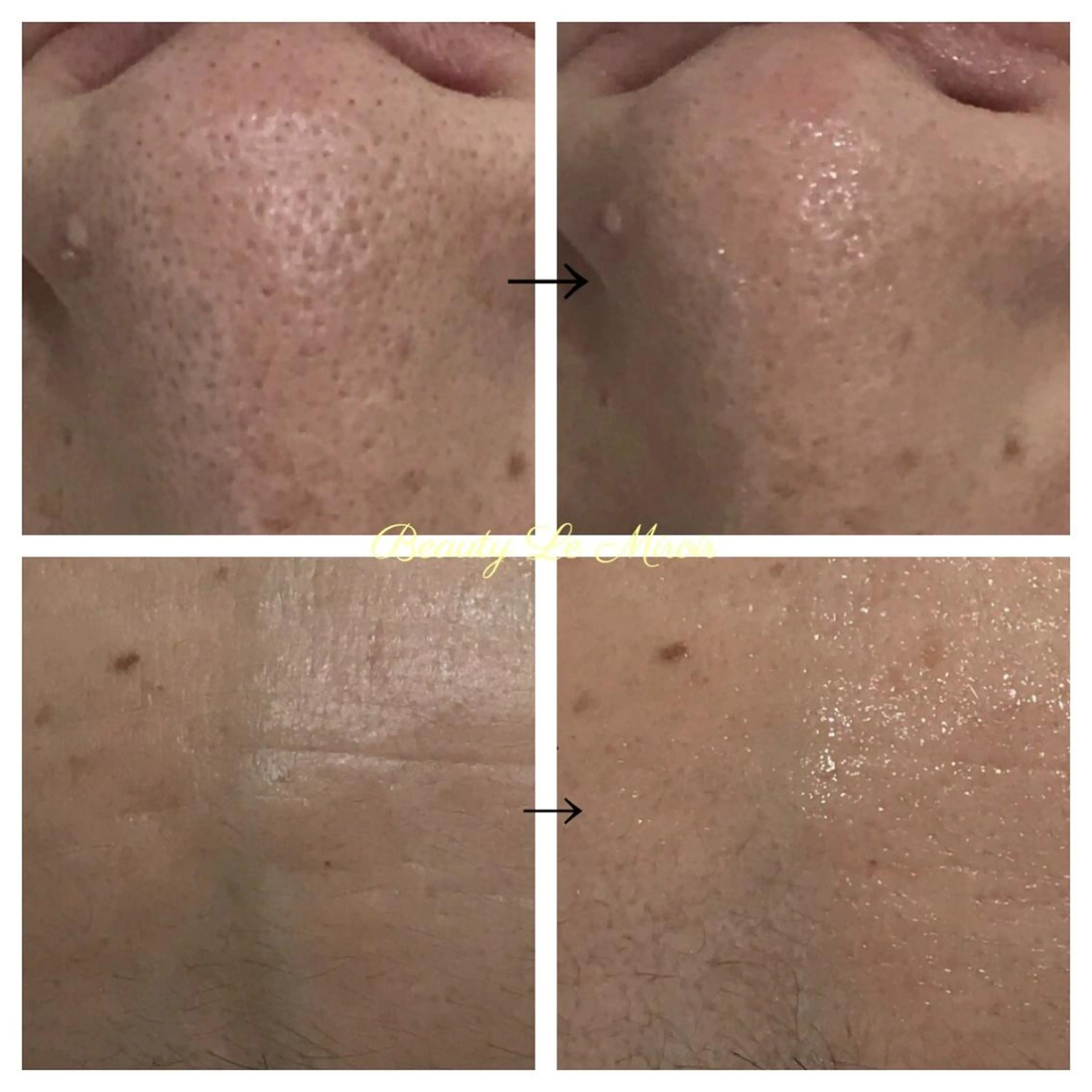 ビューティー ミロワールのエステ・リラクイメージ