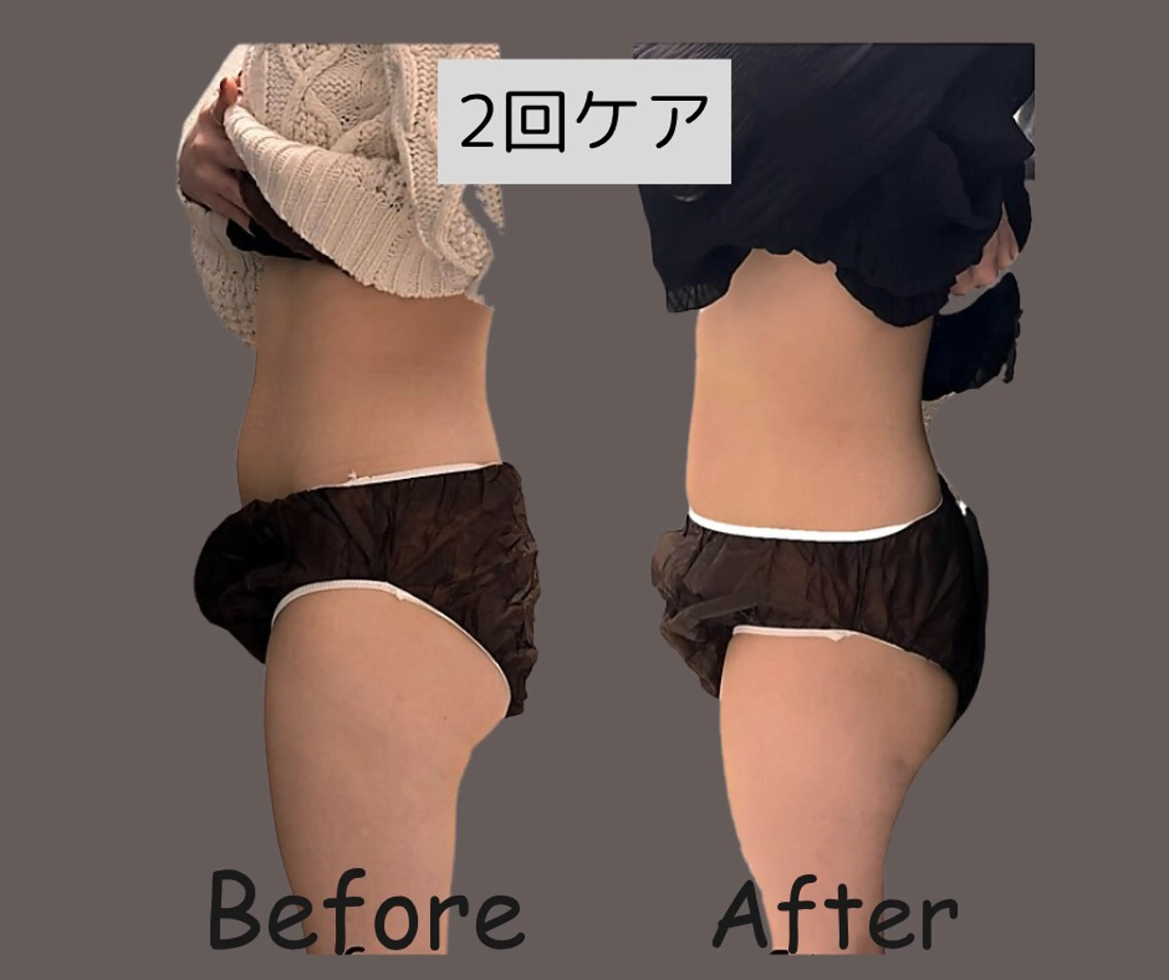 エステ 【脂肪冷却痩身サロン】una.福岡所属・UNA 福岡のエステ・リラクイメージ