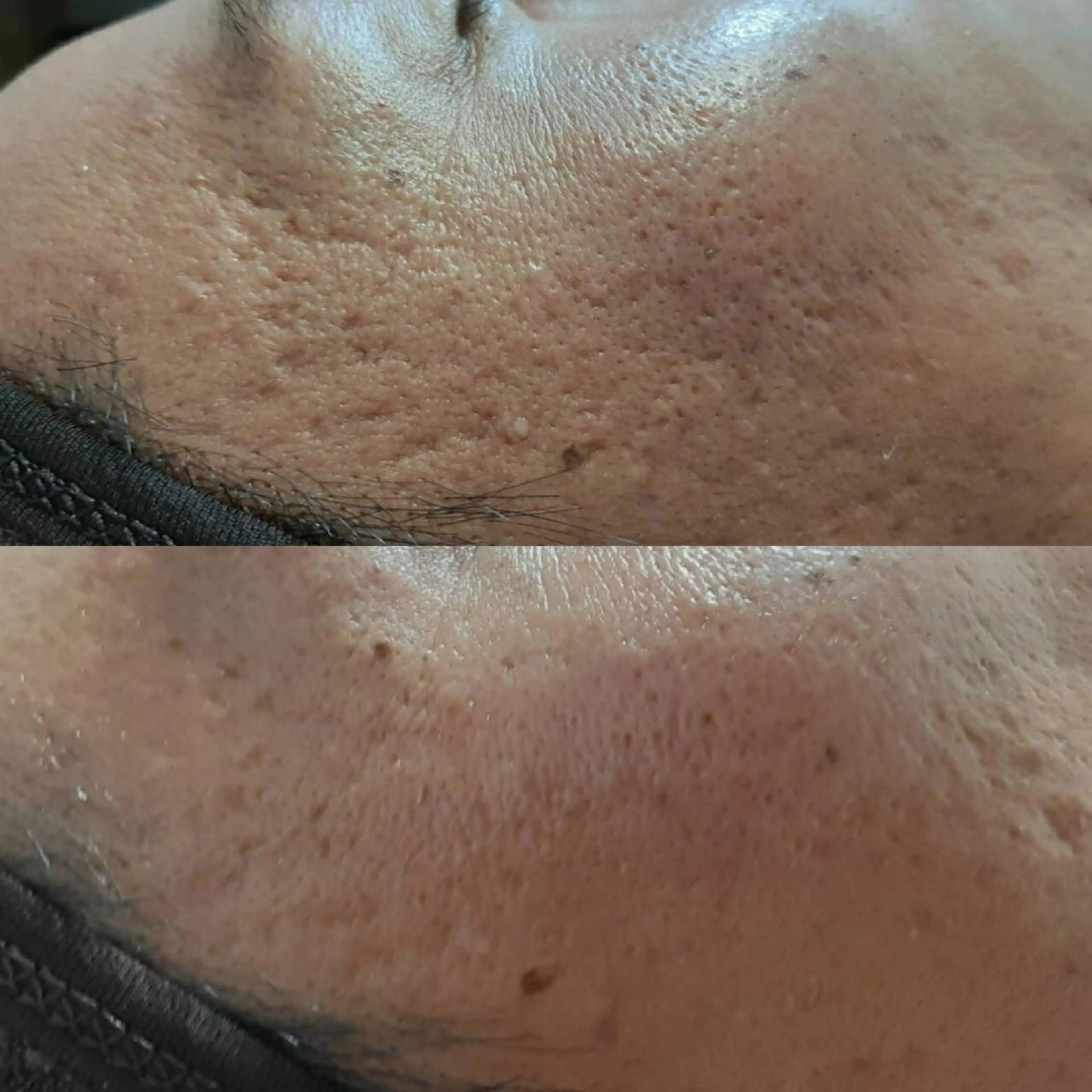 マツエク・マツパ eyelash  e'nのネイルデザイン