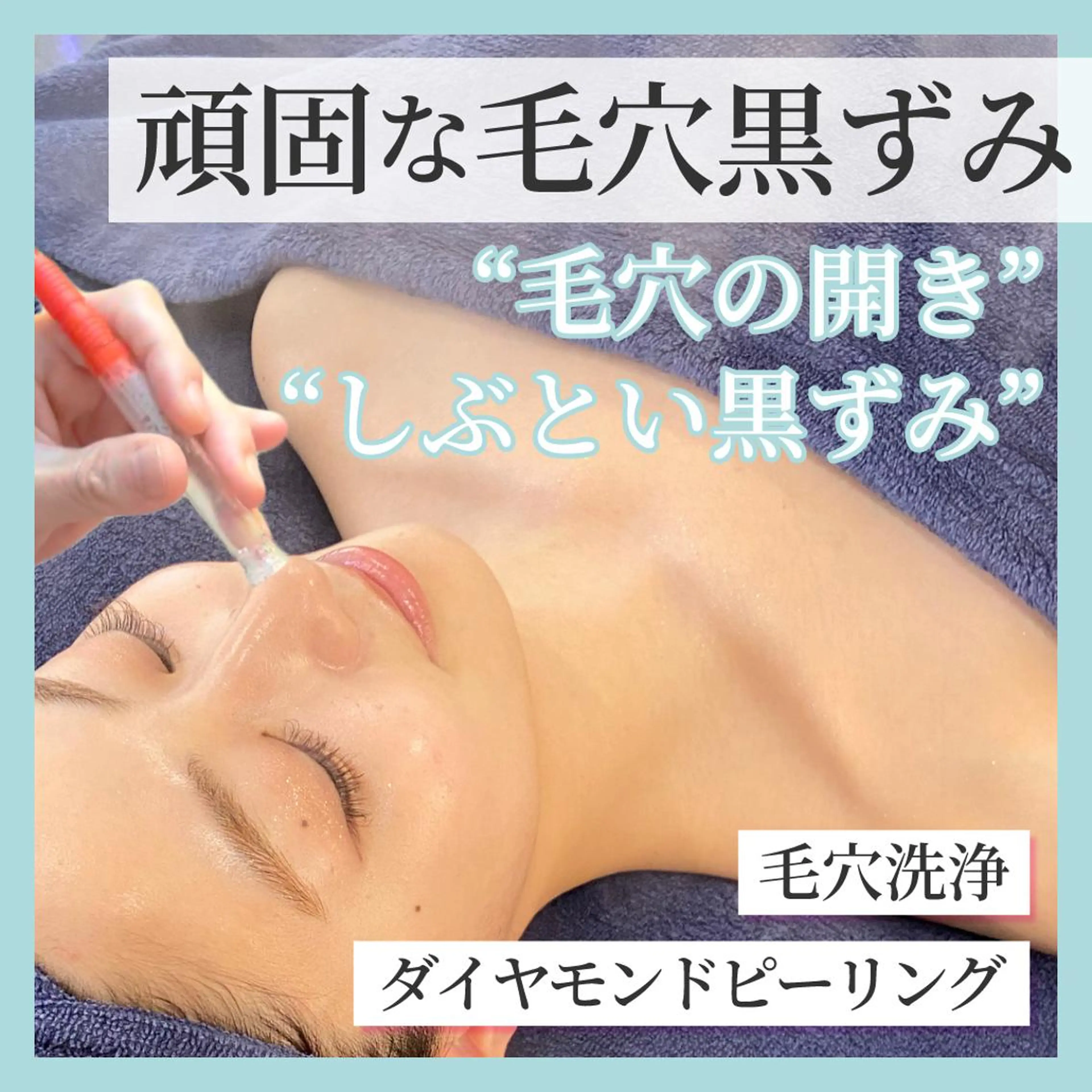 諦めていた頑固な毛穴黒ずみ《韓国式★浮き出す毛穴洗浄+艶肌ピーリング》の写真