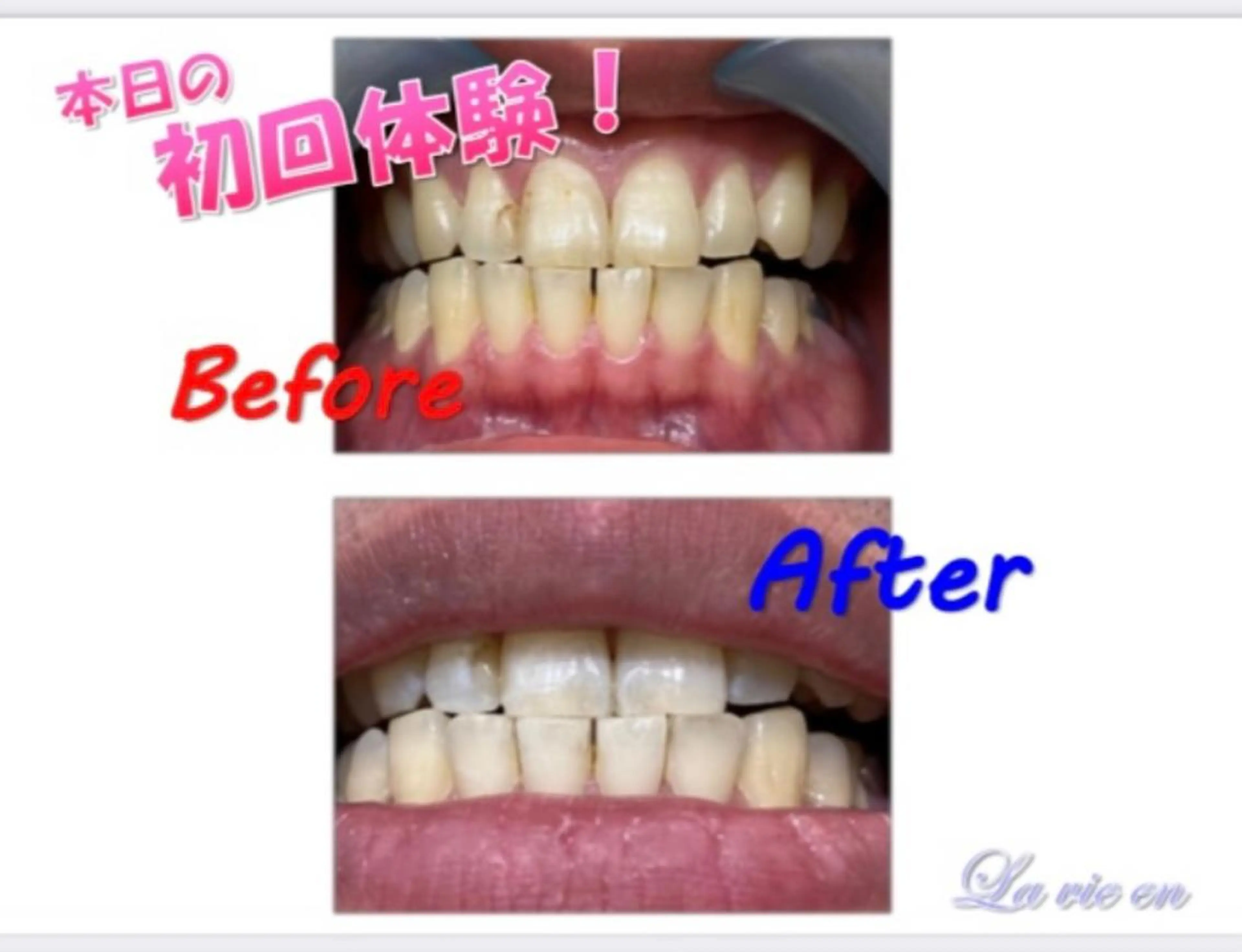 その他 ホワイトニングサロン La vie enのその他イメージ