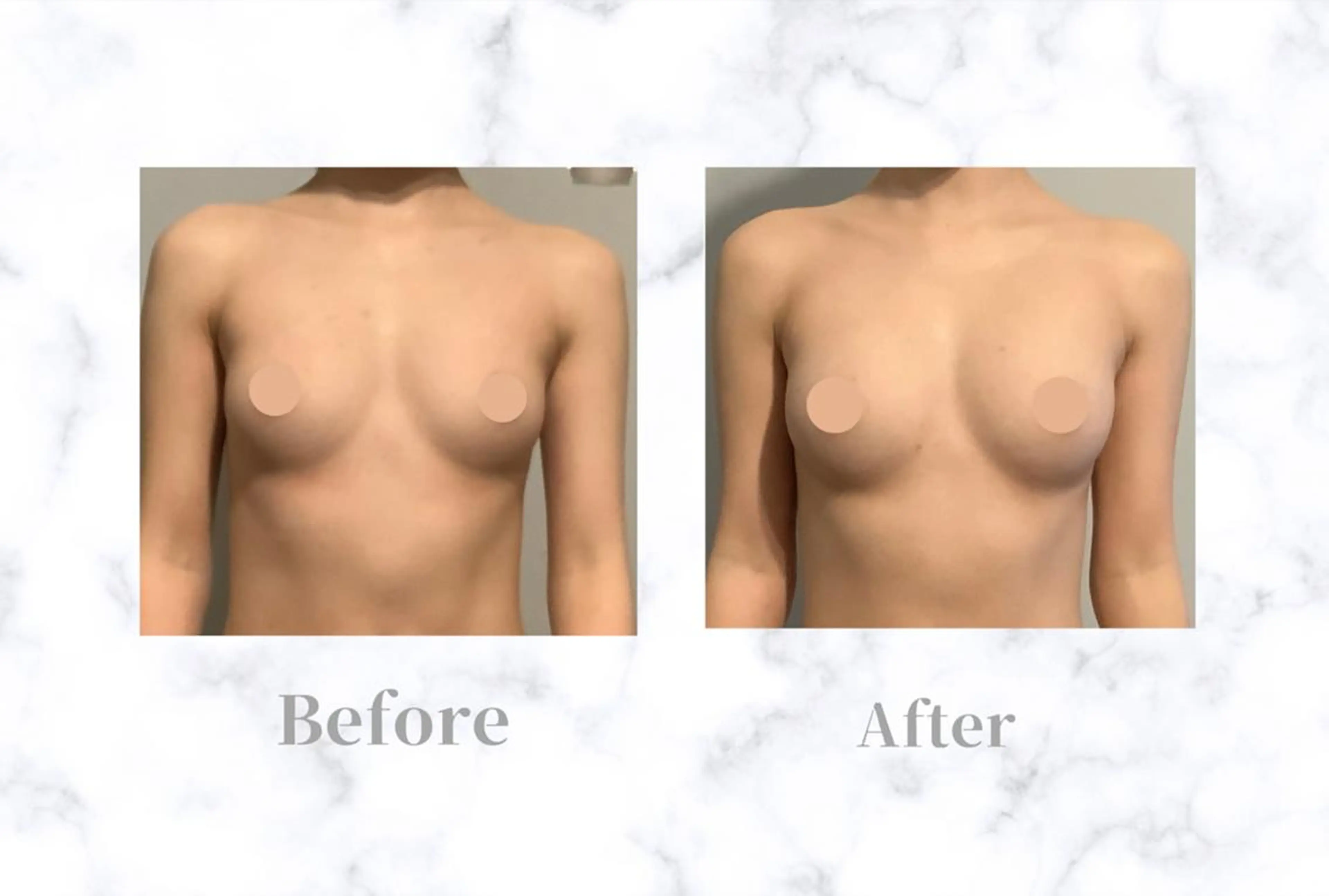 エステ リラク バスト専門&リラク ふじこのきもちのエステ・リラクイメージ