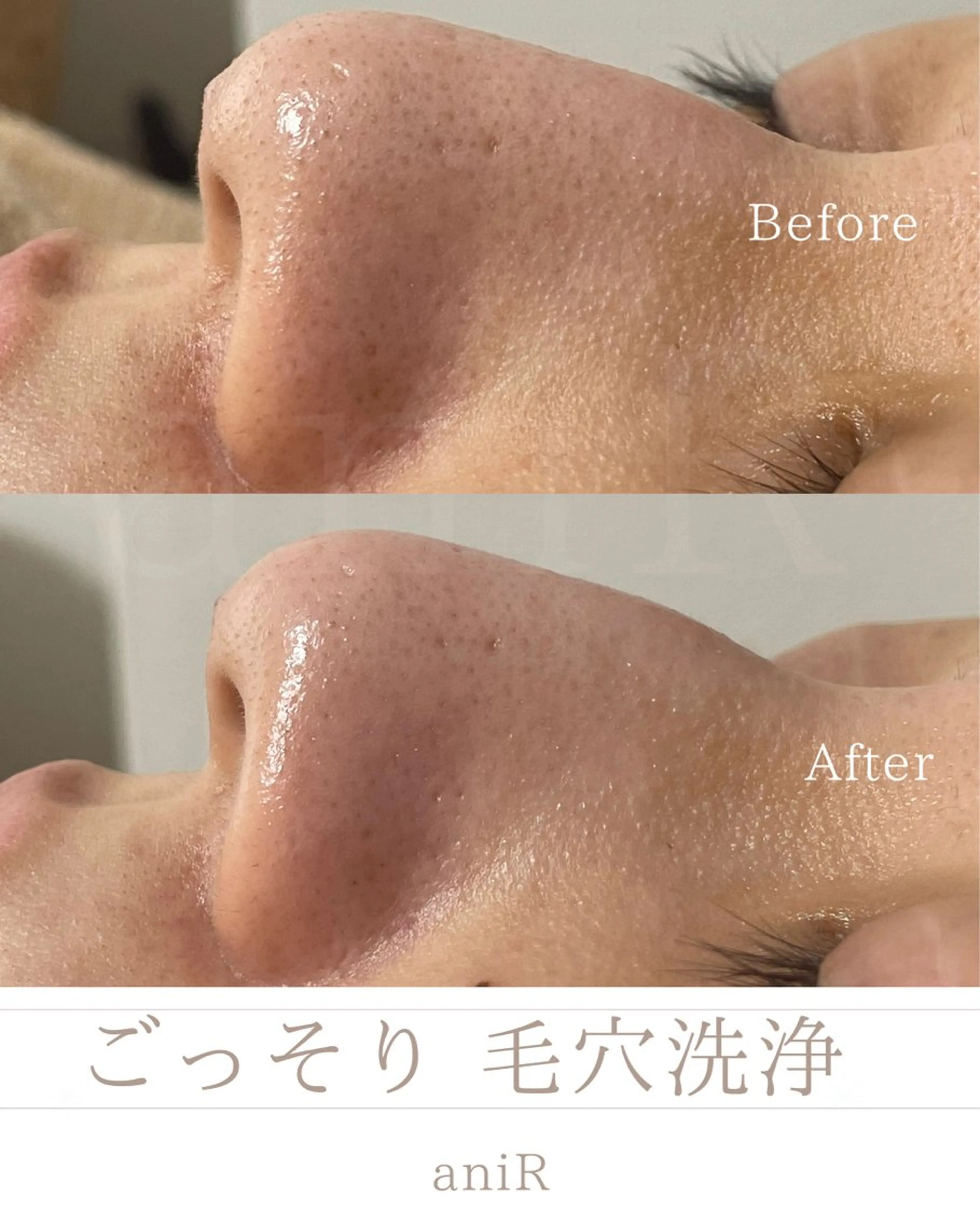 北浜/毛穴洗浄ツヤ肌 サロンaniRのエステ・リラクイメージ