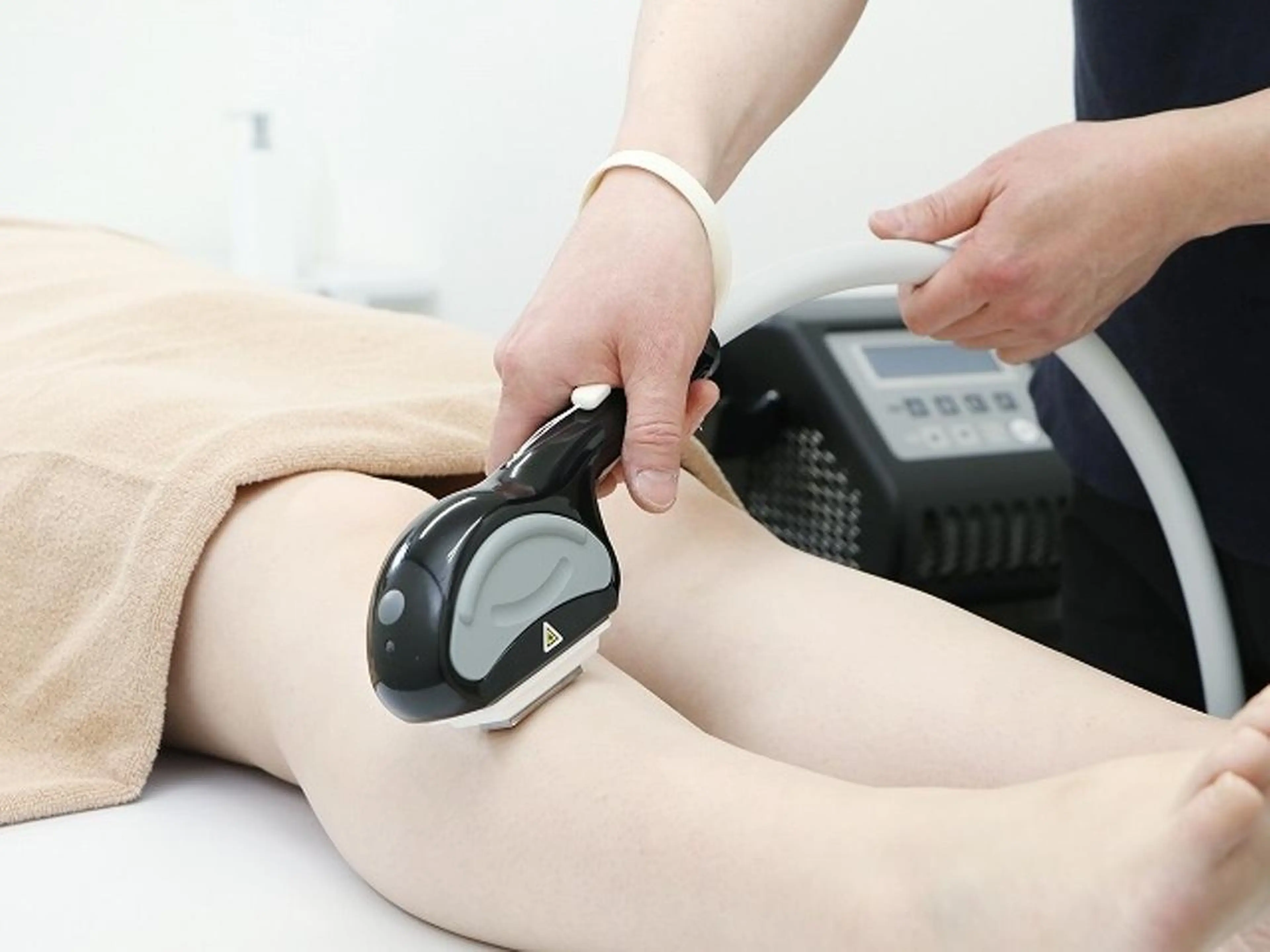 脱毛(うなじ)の写真