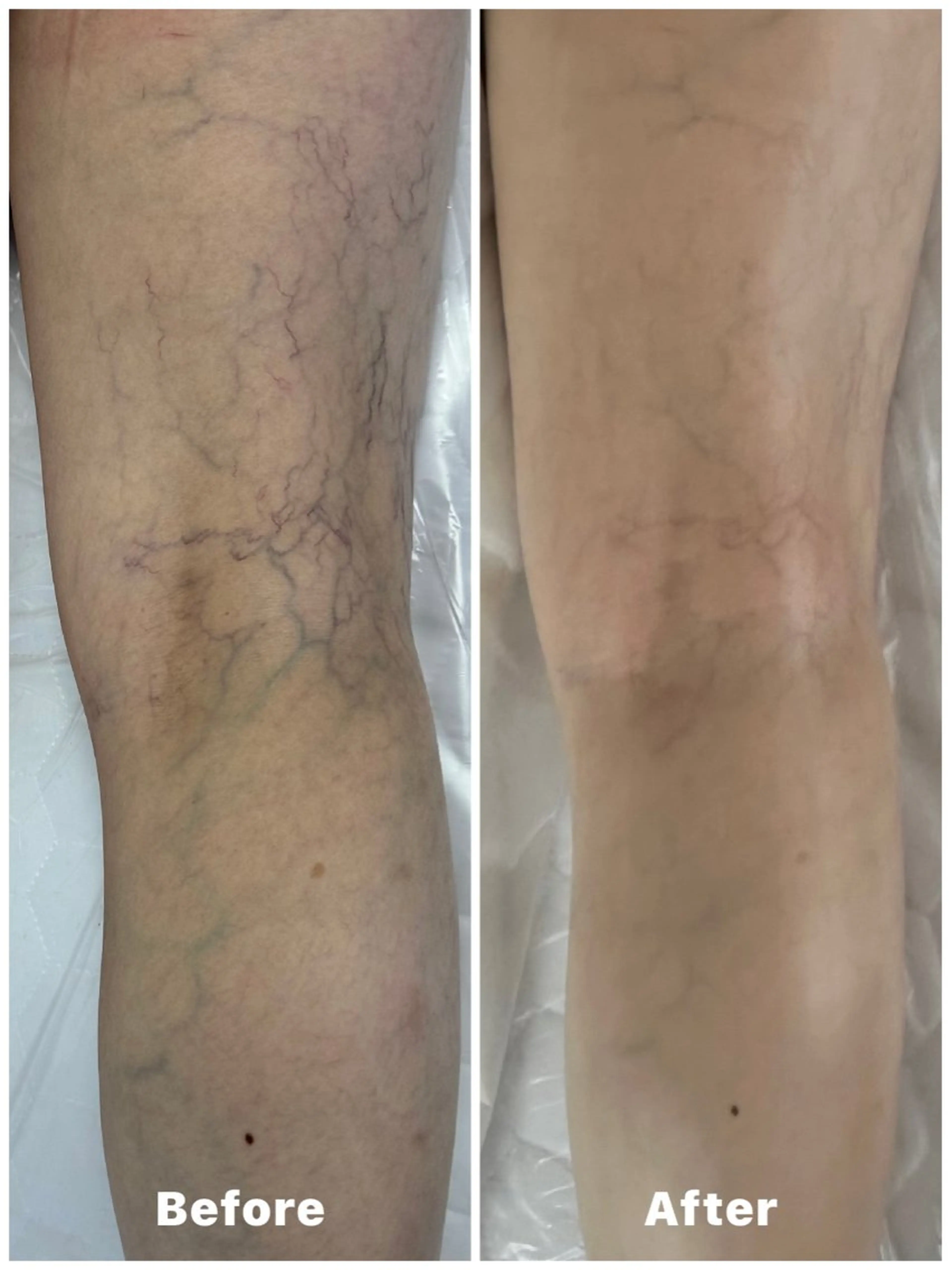 エステ リラク 心と体が整う腸活 サロン ラクシュミーのエステ・リラクイメージ