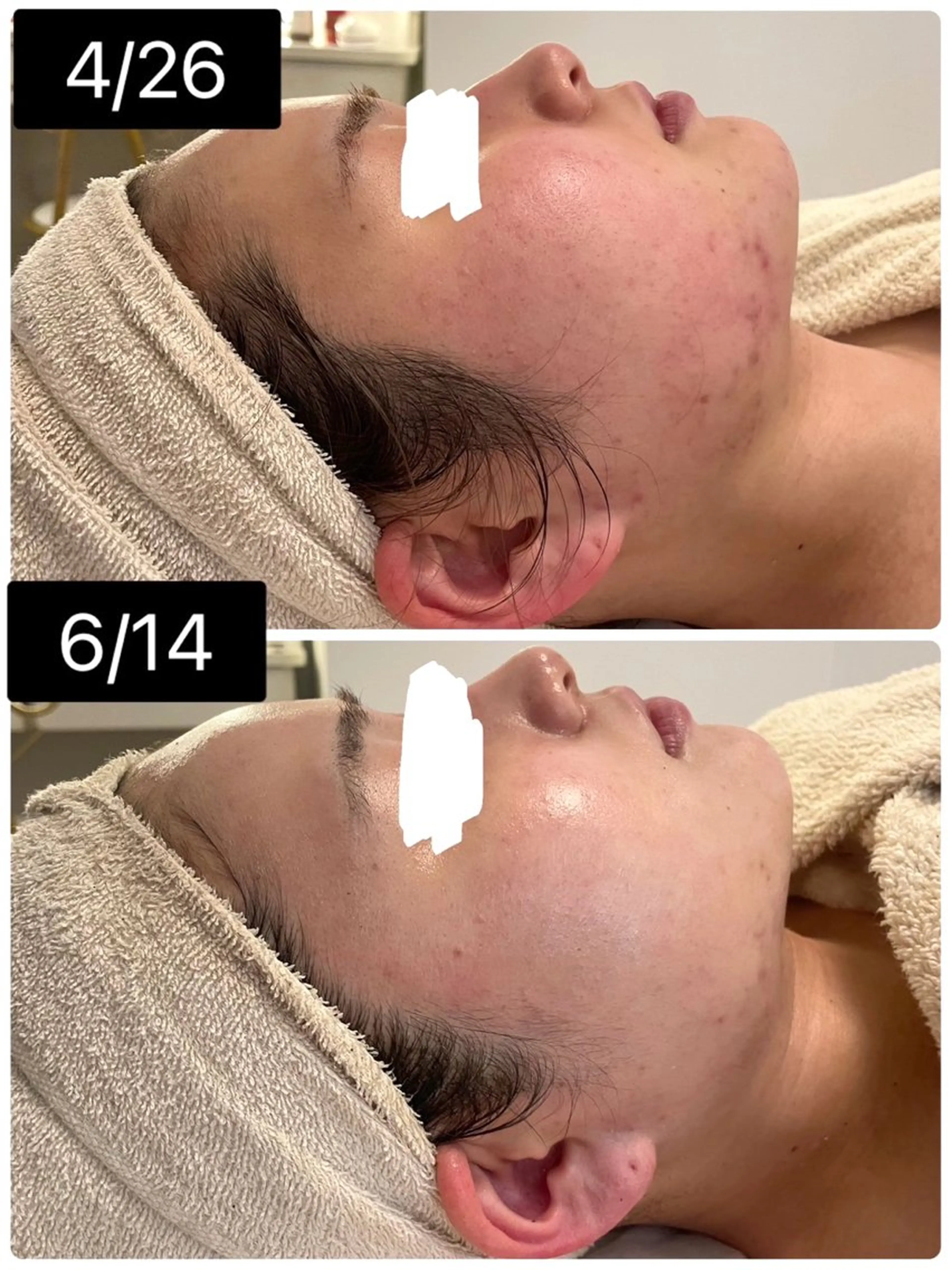 エステ 肌のお悩み改善サロン MELIA/朋美のエステ・リラクイメージ