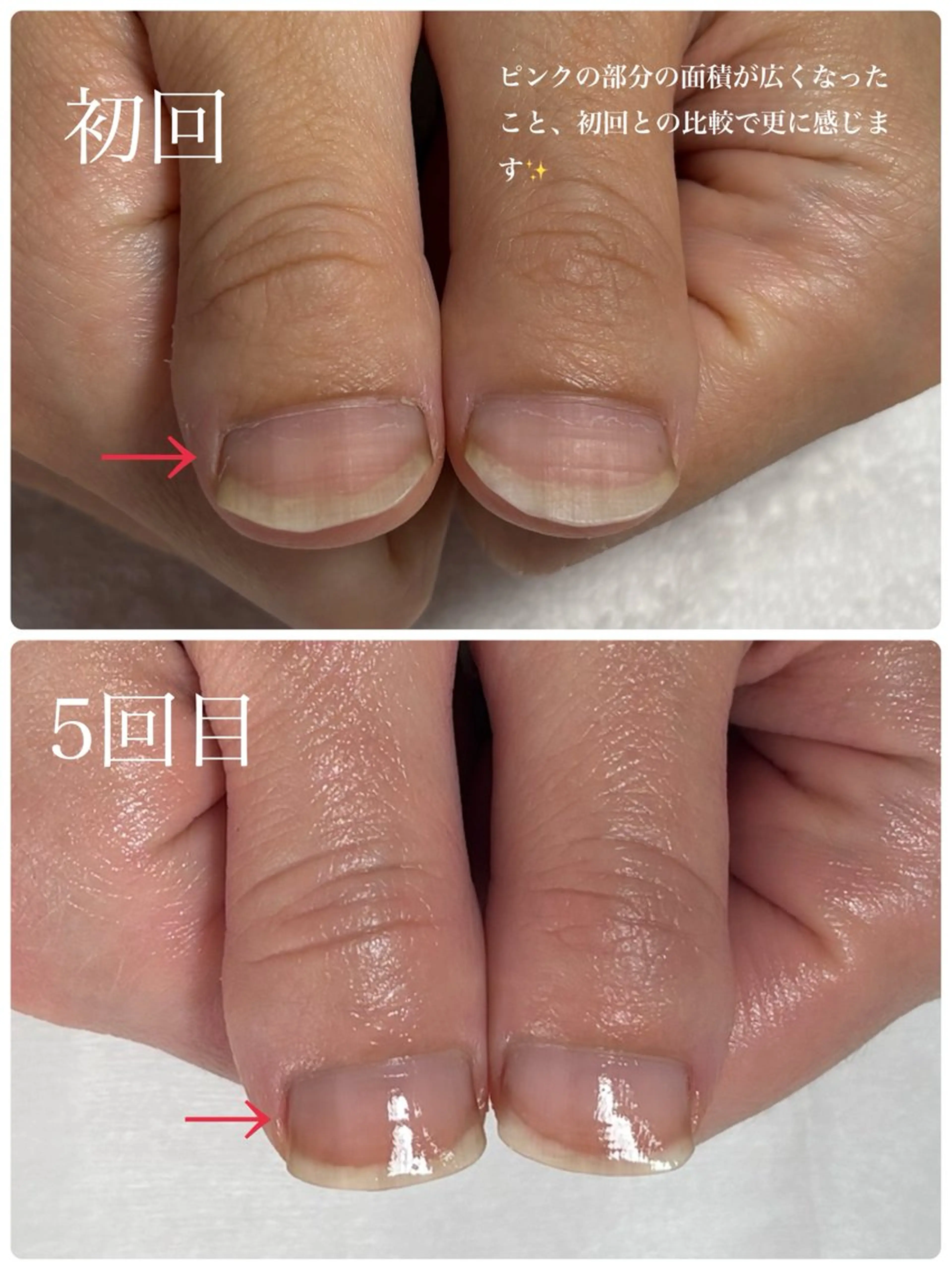 ネイル Alo.nail アロ•ネイルのネイルデザイン