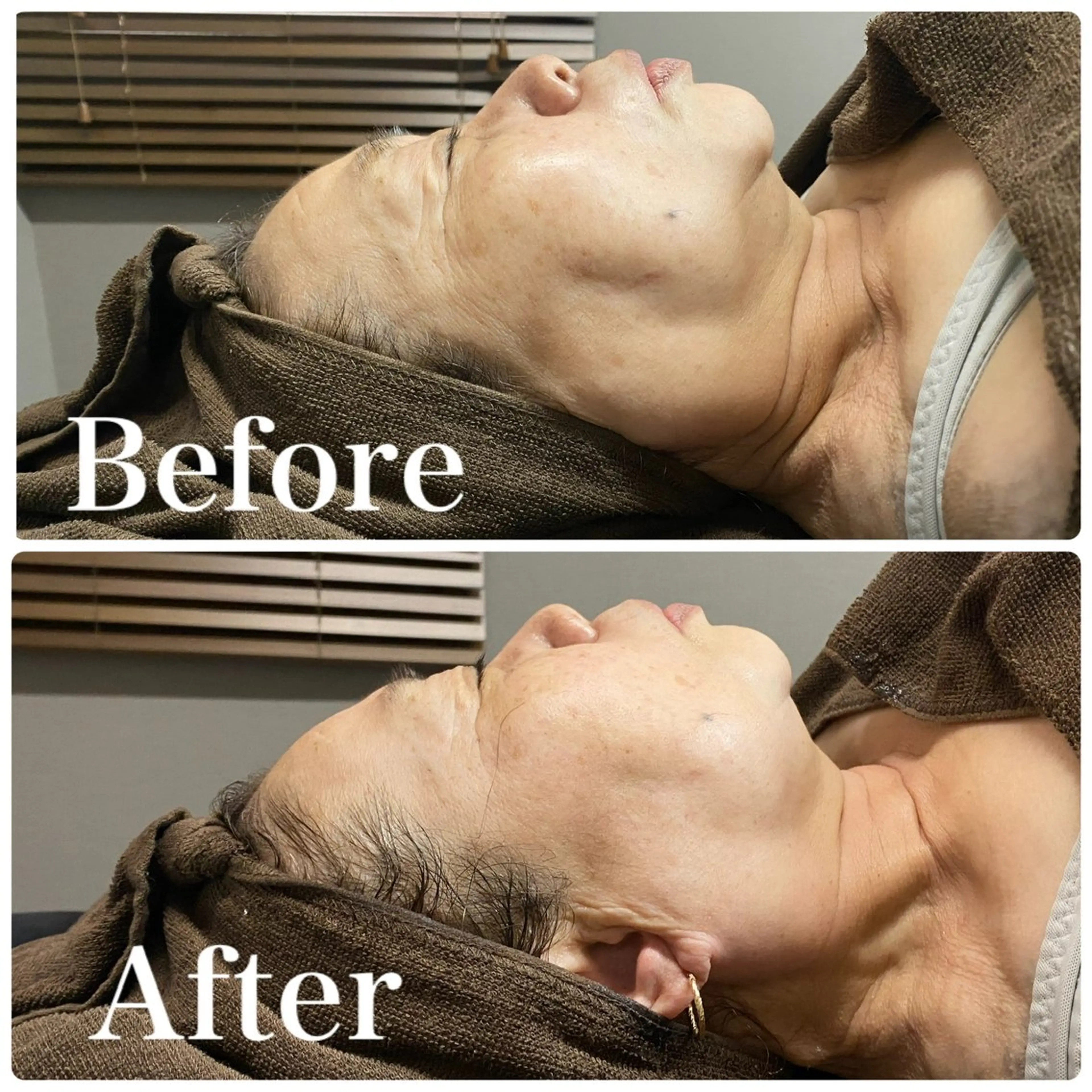 💎小顔ｻﾛﾝ アリリン銀座💎のエステ・リラクイメージ