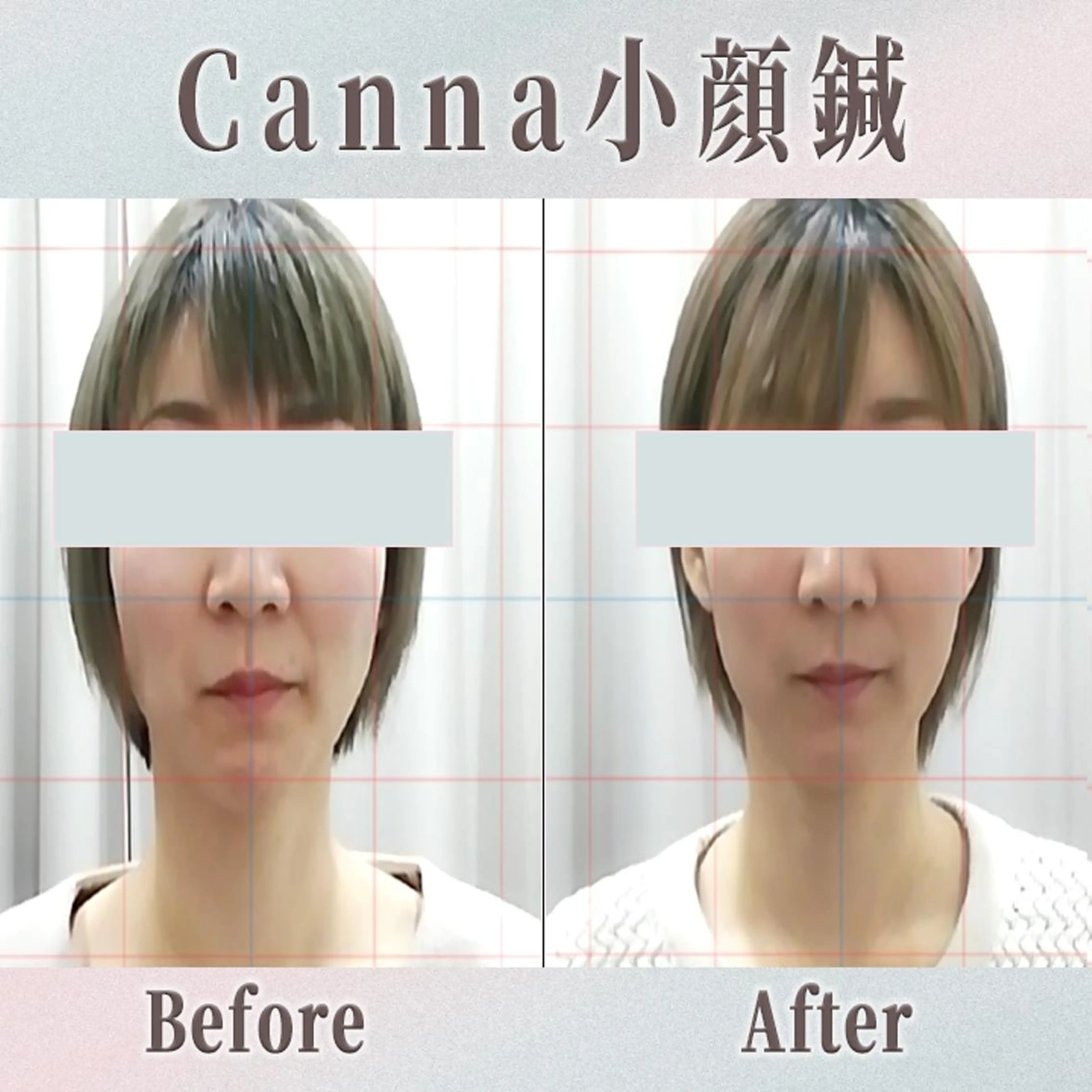 エステ リラク 【美容鍼・小顔鍼】 鍼灸師　森原拓磨のエステ・リラクイメージ