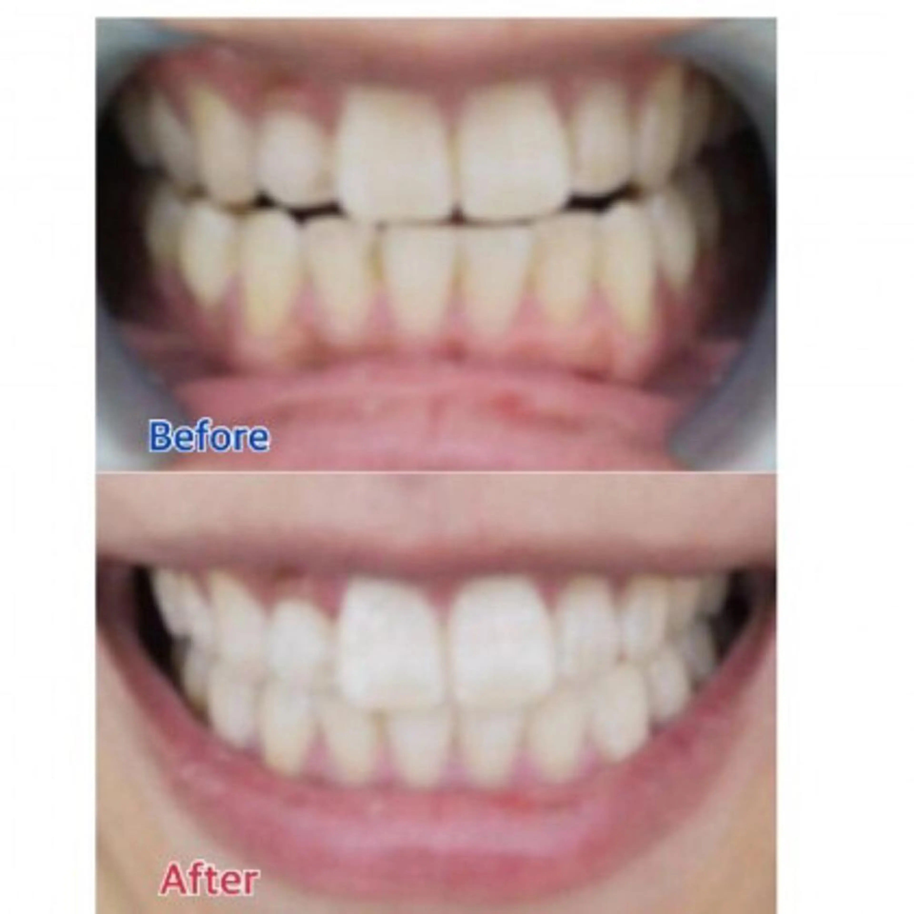 Ｍ渋谷 ホワイトニングのエステ・リラクイメージ