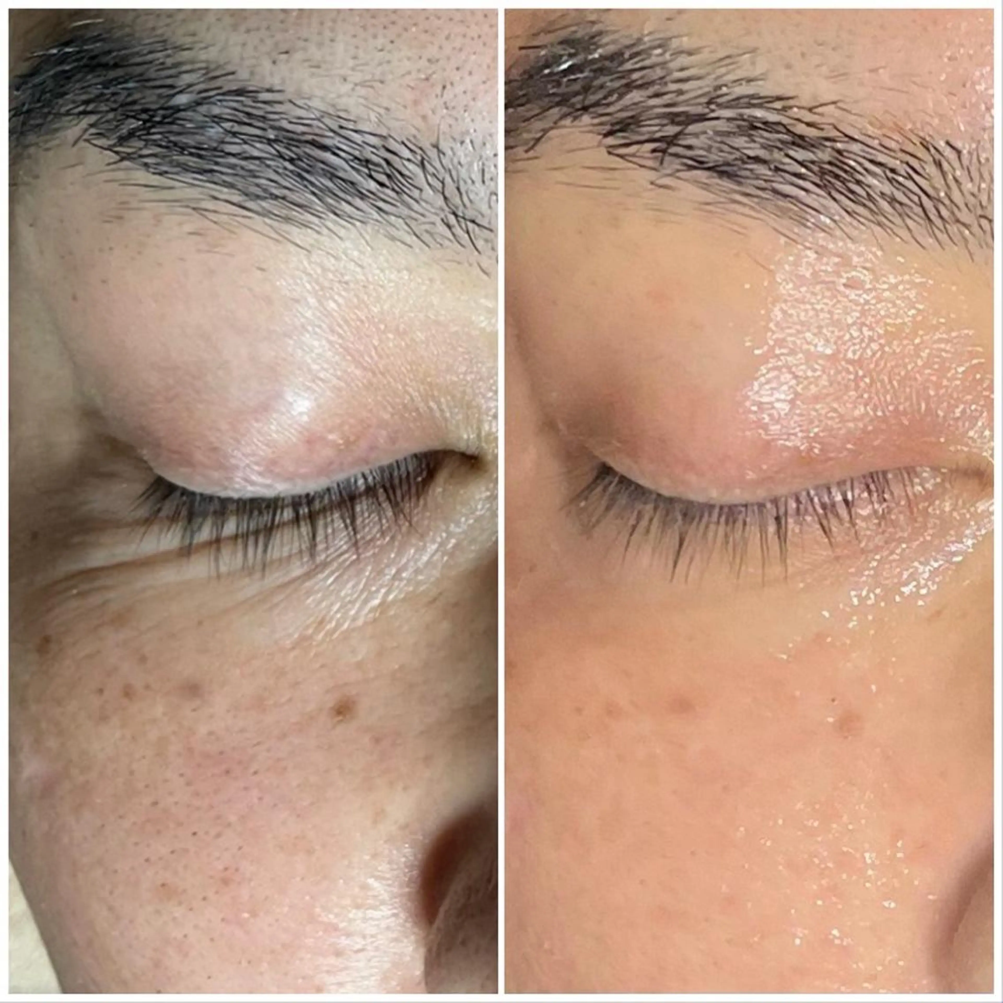 代表 MOMOのエステ・リラクイメージ