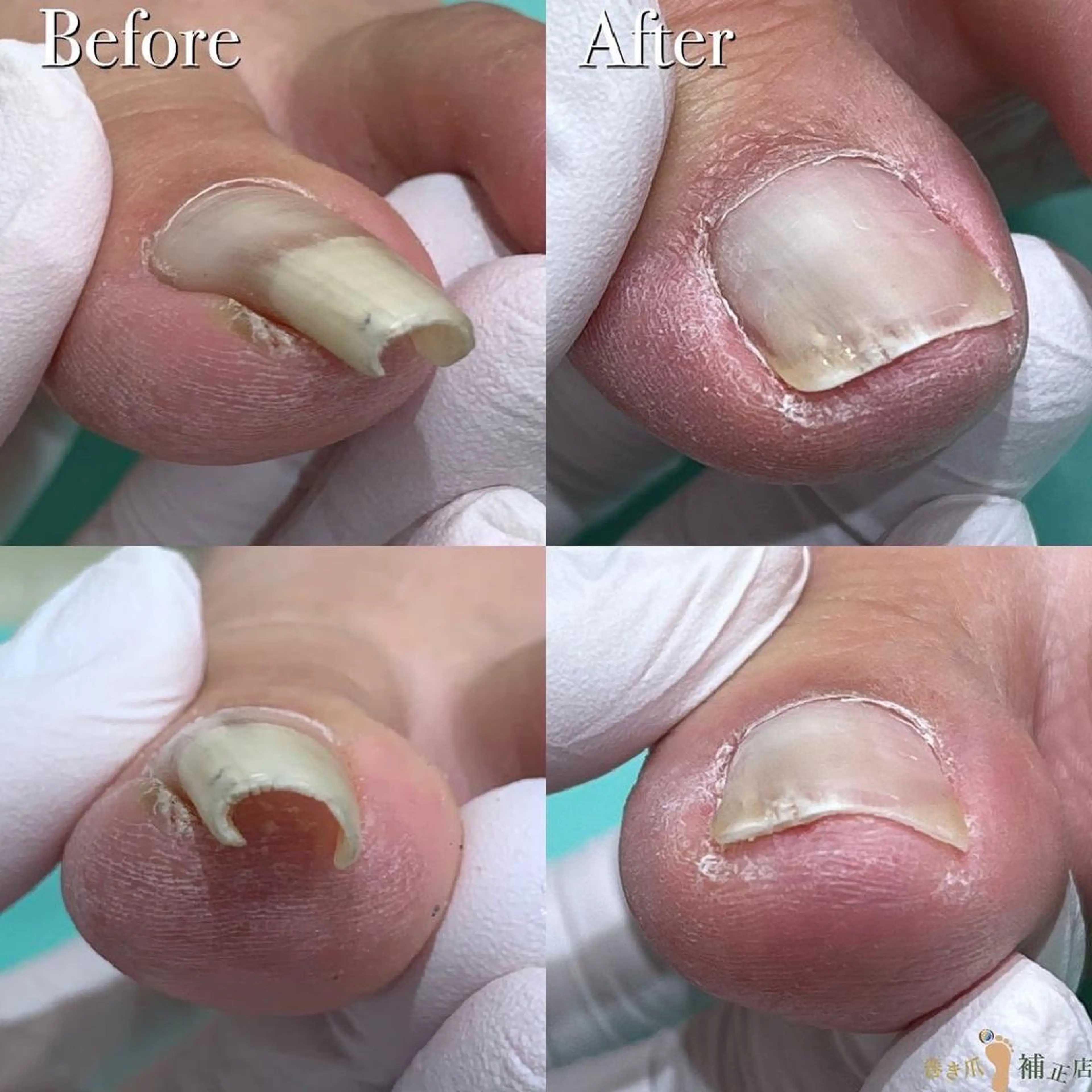 東京巻き爪 アカデミーのエステ・リラクイメージ