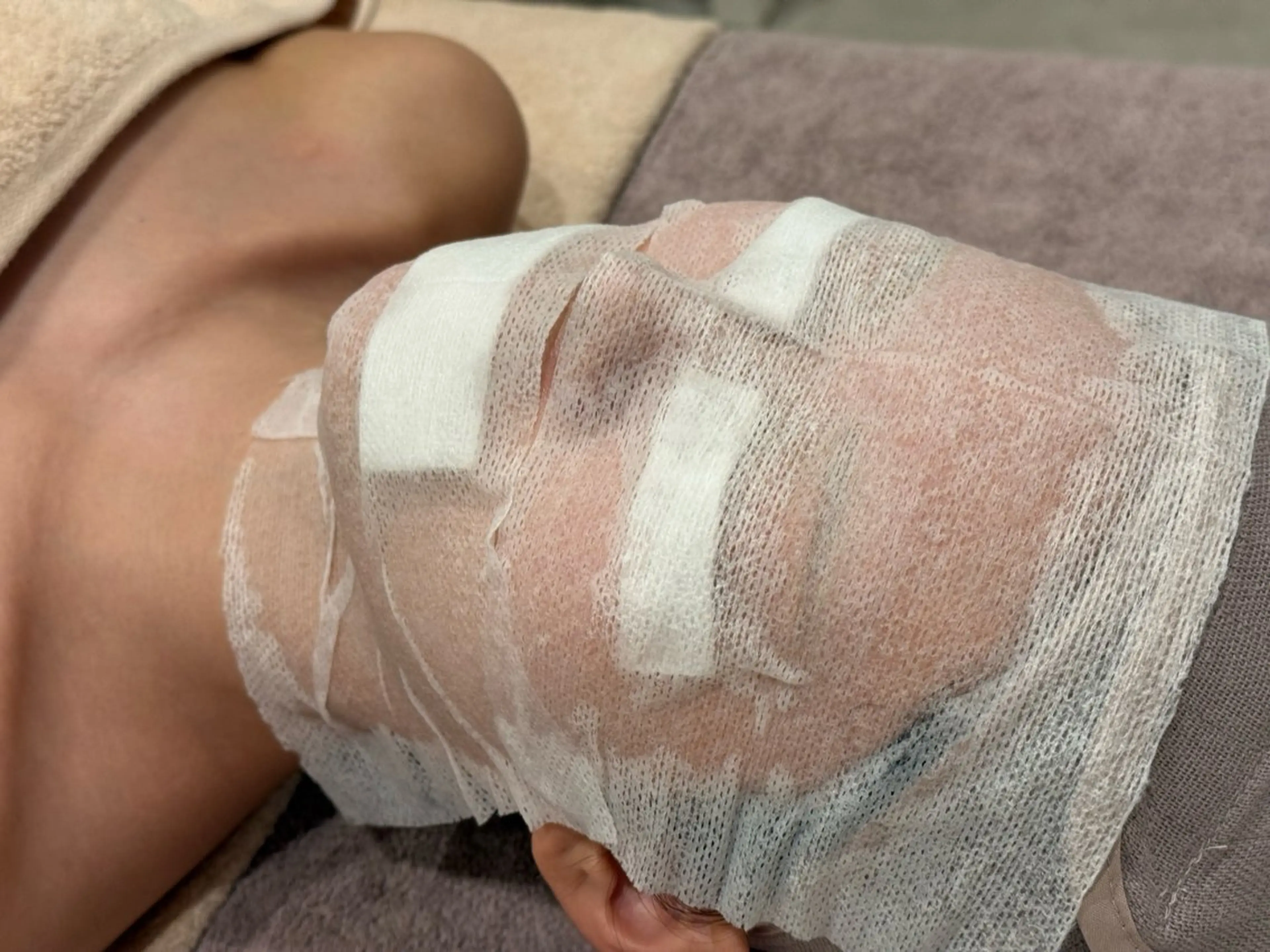 バクテリウムピールの写真