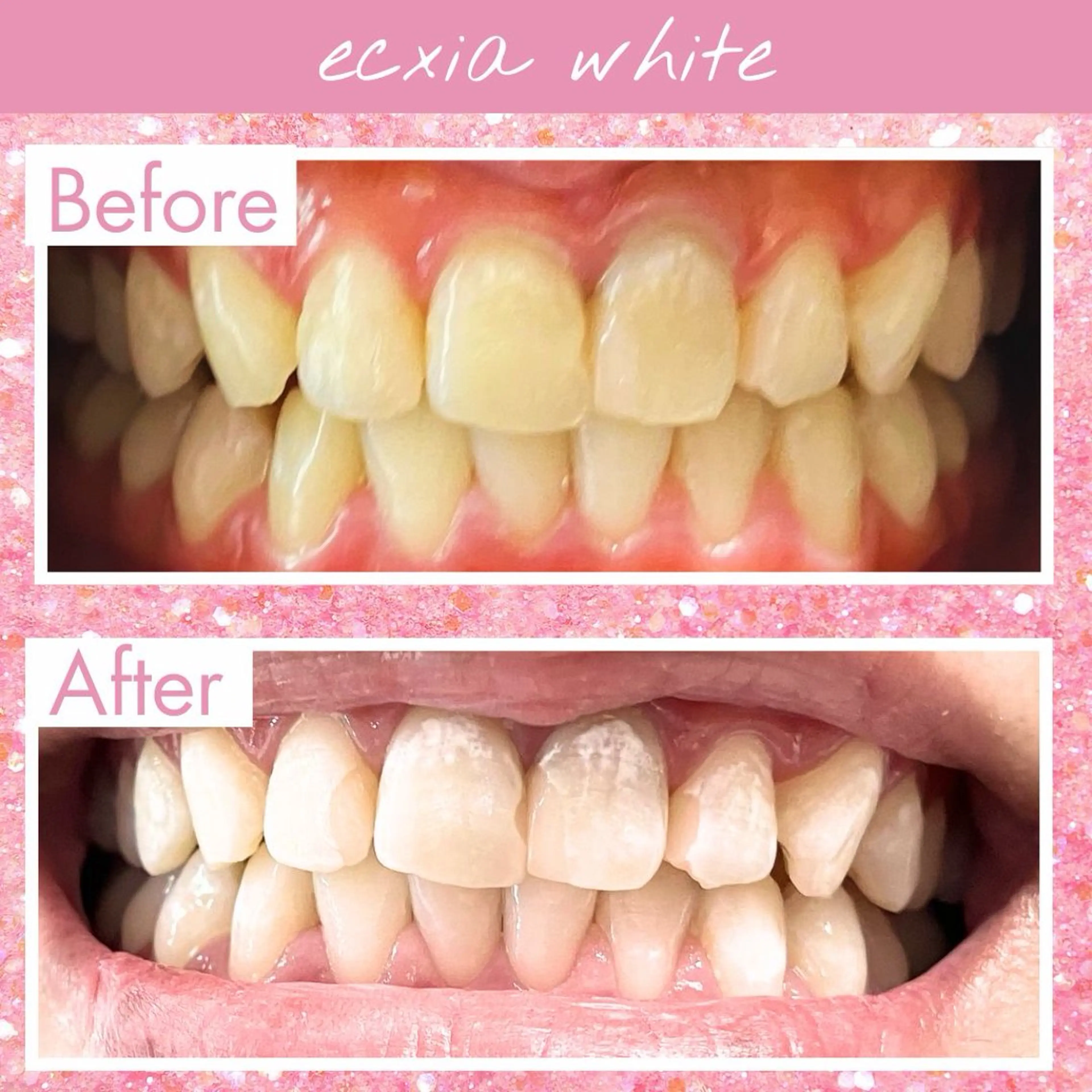 セルフホワイトニング エクシア町田店のその他イメージ