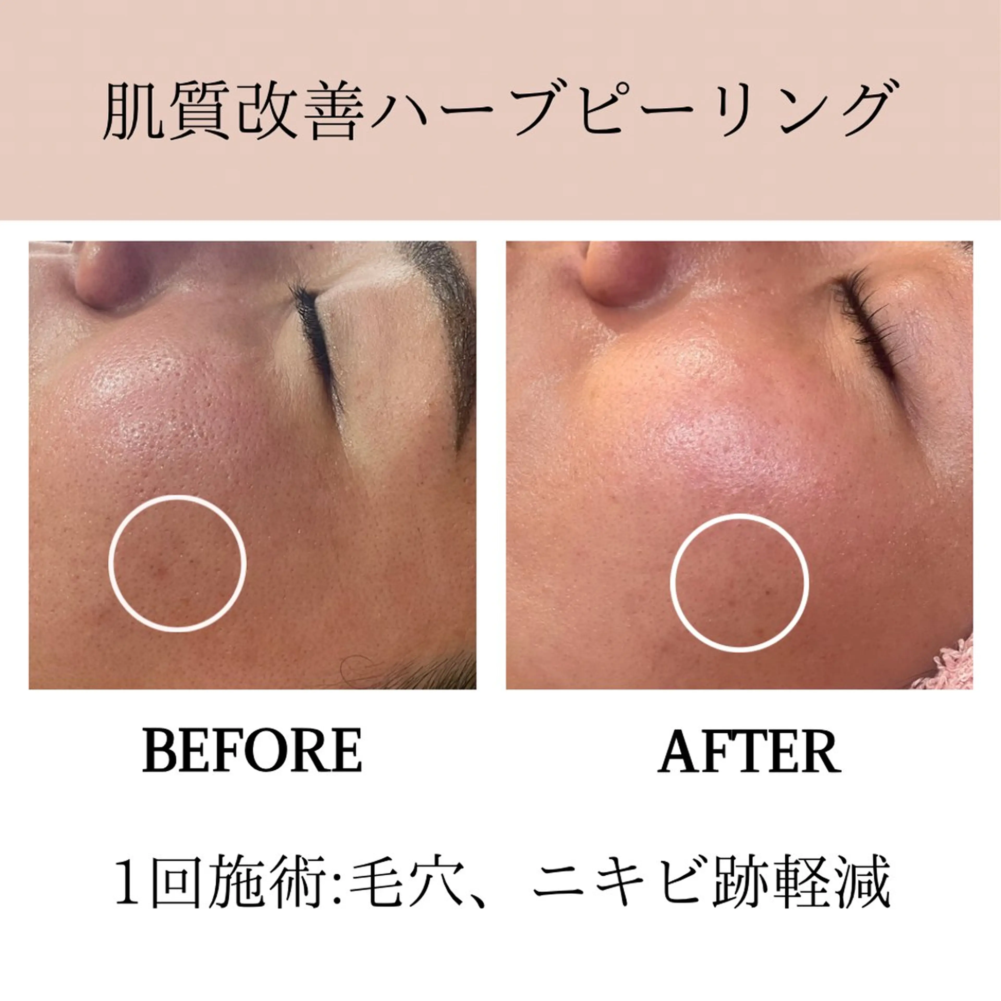 エステ 肌質改善専門サロン Bellmi/心斎橋のエステ・リラクイメージ