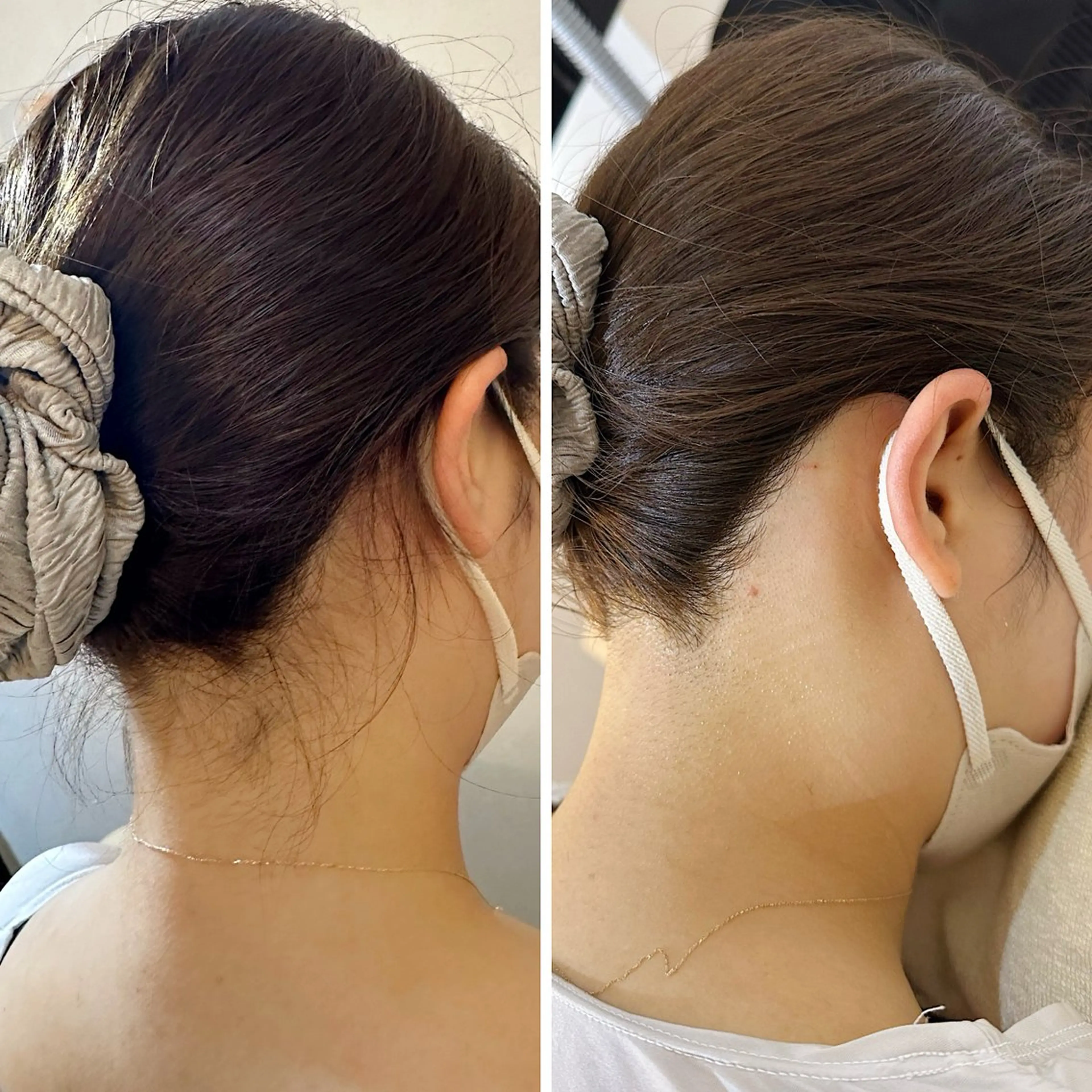 脱毛 うなじ脱毛/美肌脱毛 LABELのエステ・リラクイメージ