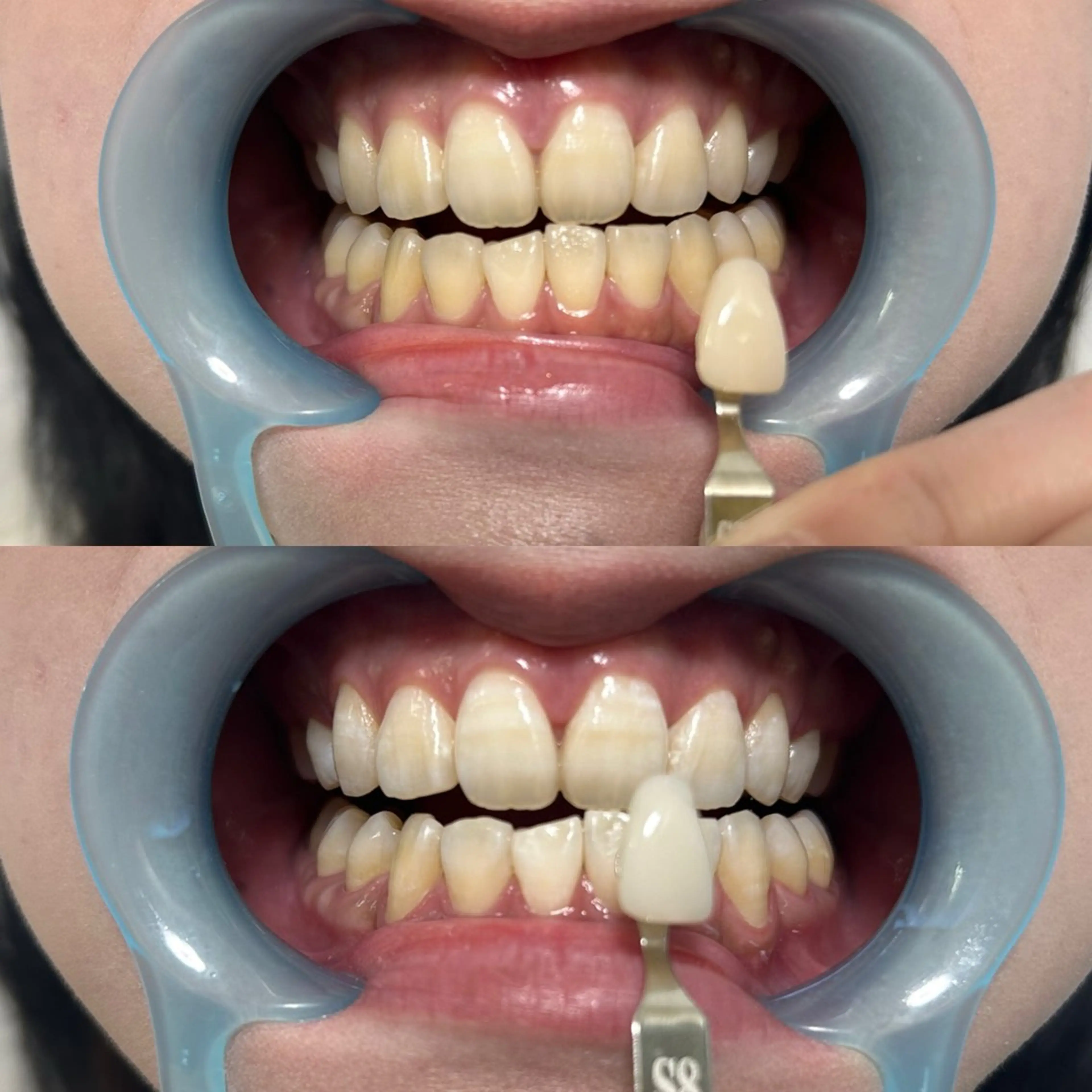 メンズ 九州オーラルホワイトニング所属・田中 毬亜/薬院警固店のエステ・リラクイメージ