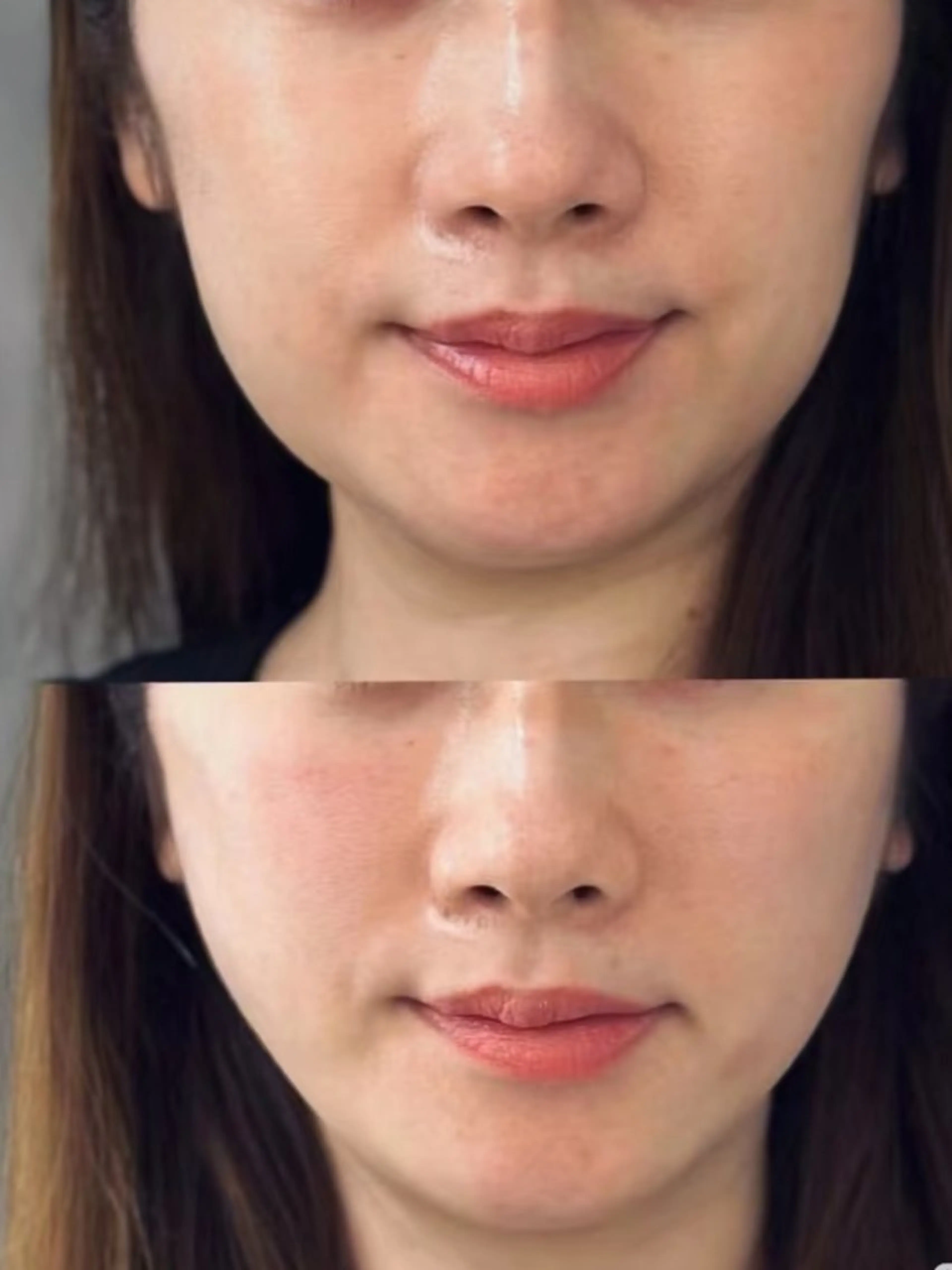 エステ aliaハーブ水光店 エステティシャン募集のエステ・リラクイメージ