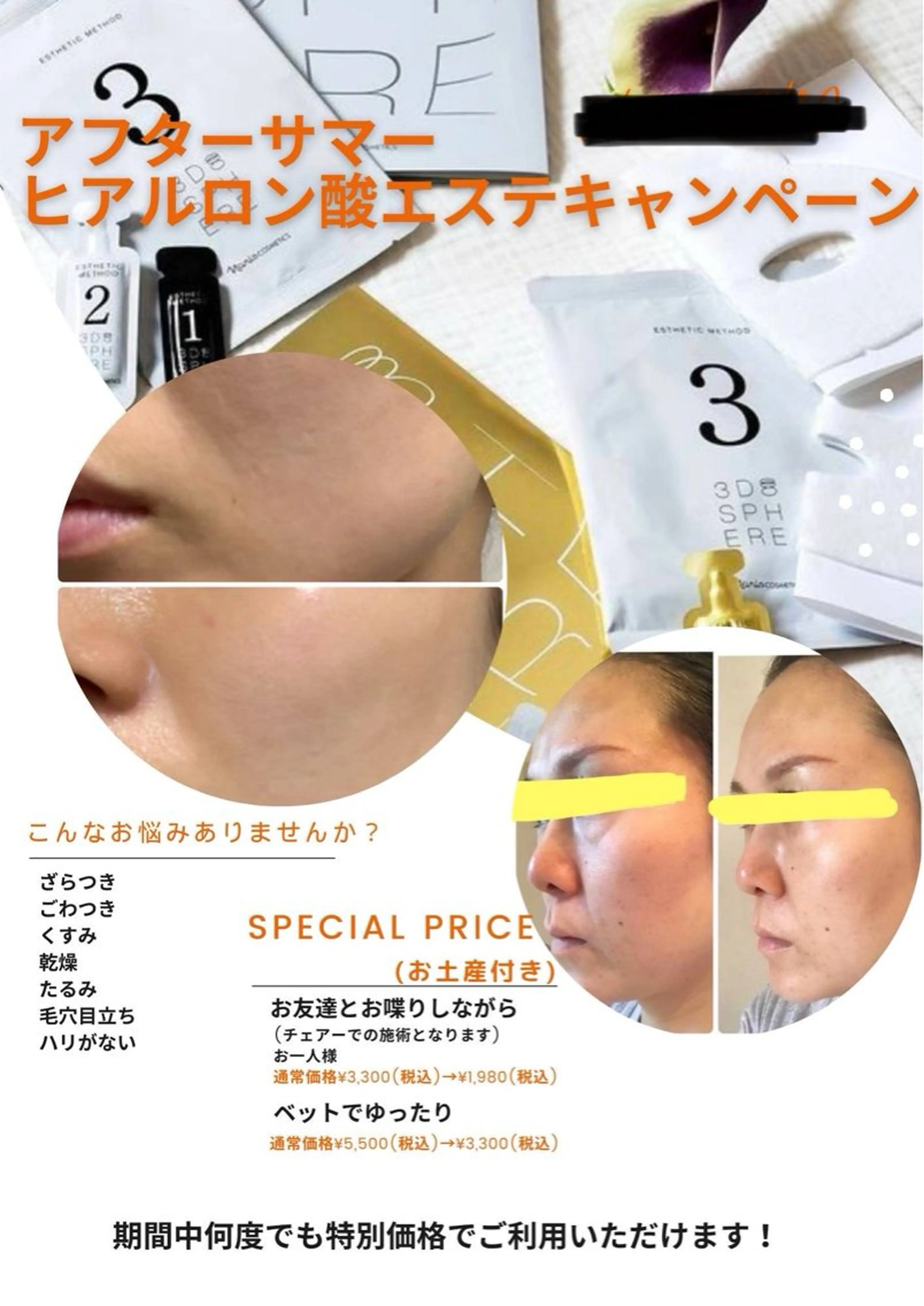 超音波ヒアルロン酸 美顔エステの写真