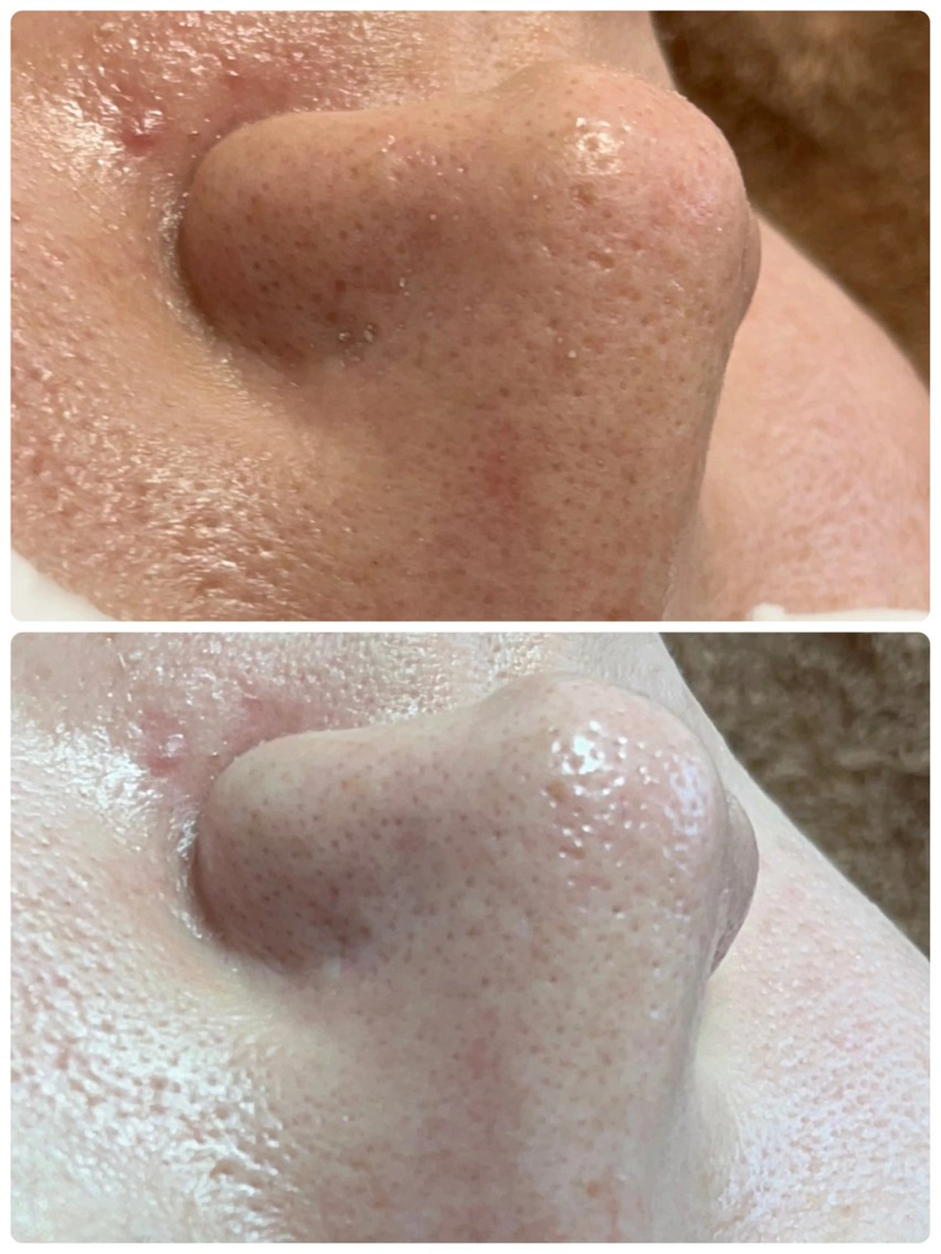 エステ 平日昼間限定★ 全メニュ¥6600のエステ・リラクイメージ