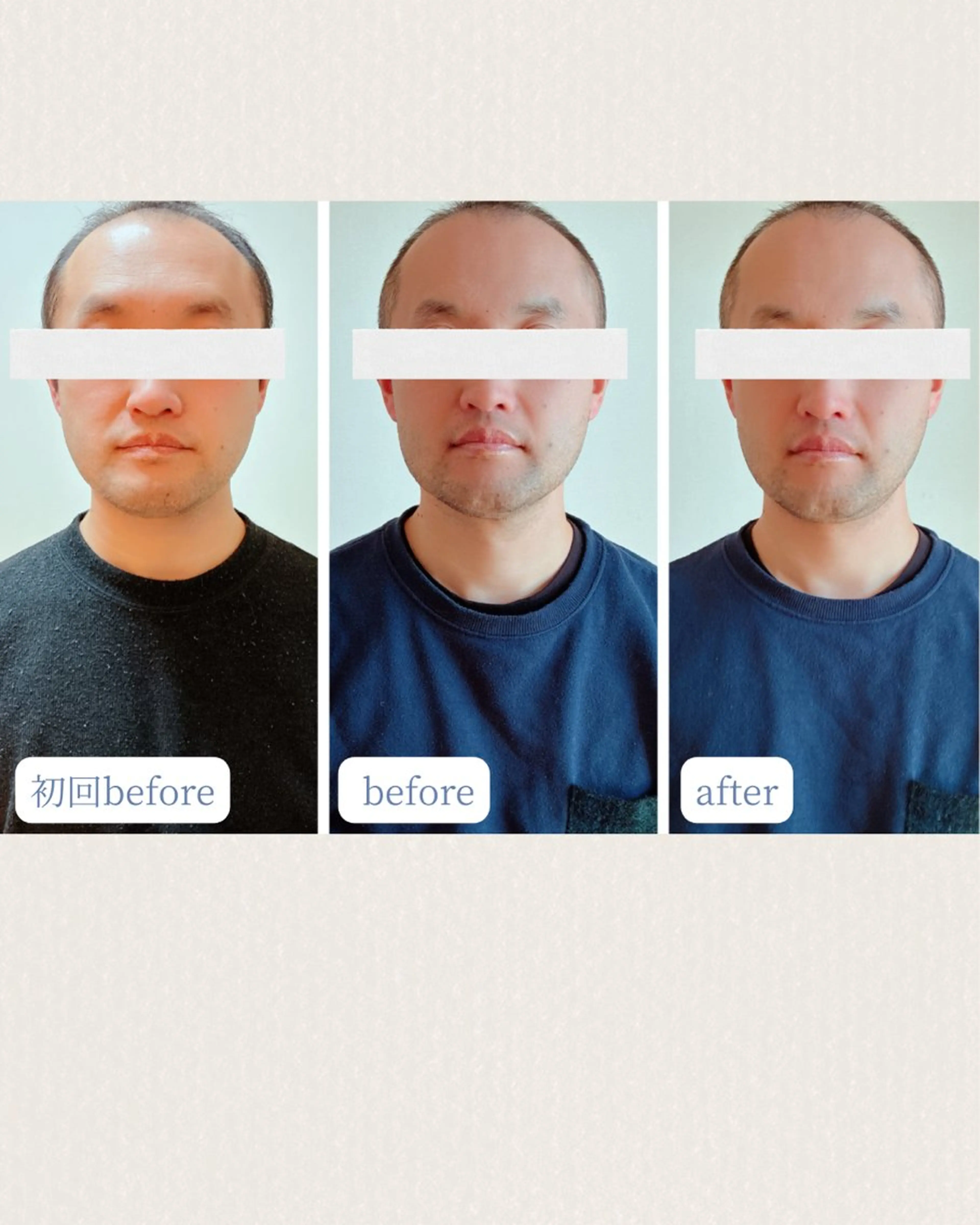 【2回目以降💎リピーター様】プチ骨格矯正+優しいタッチのリンパケア(お顔・足)60分✨の写真