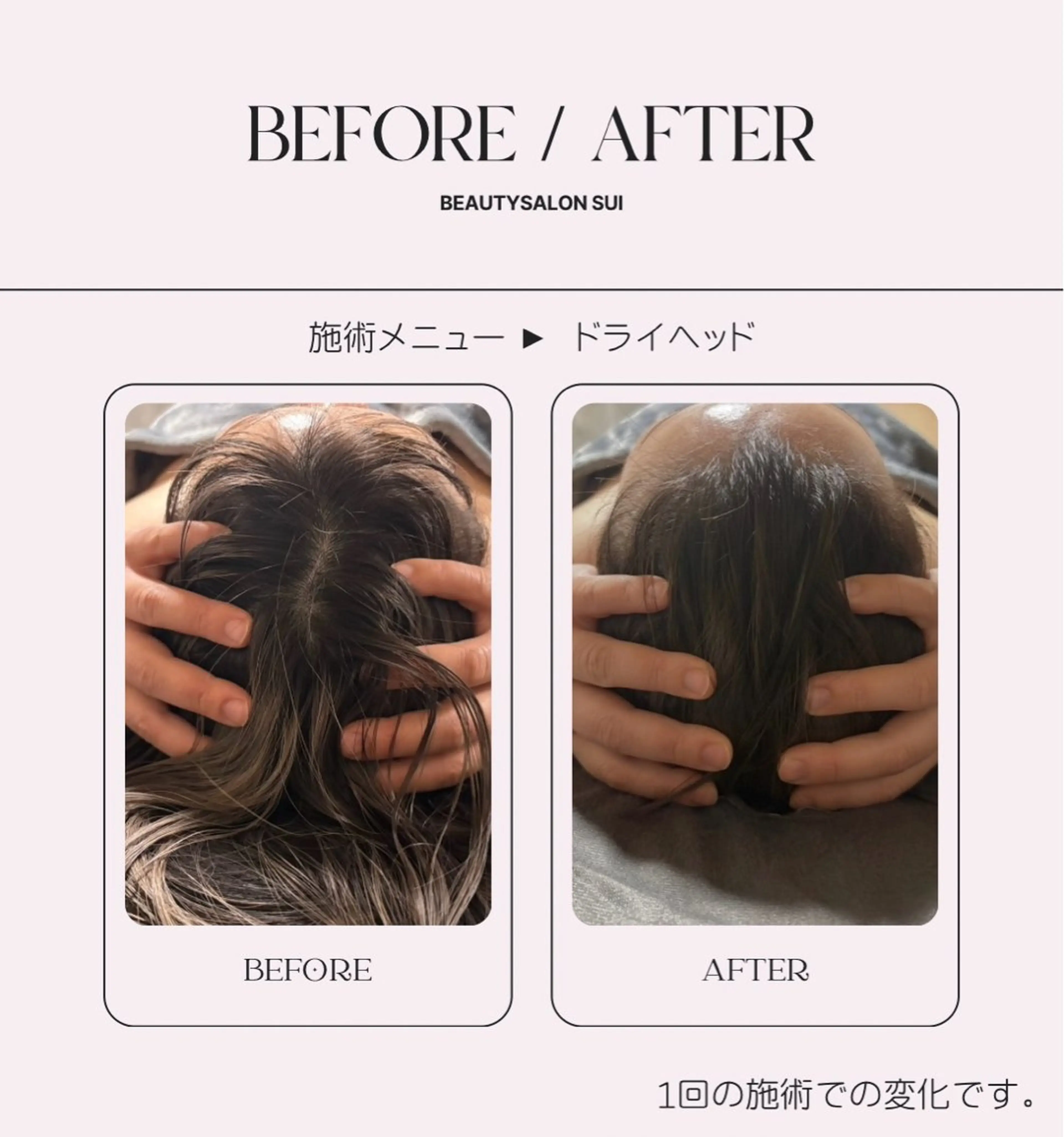 sui 翠 （AIKA）のエステ・リラクイメージ