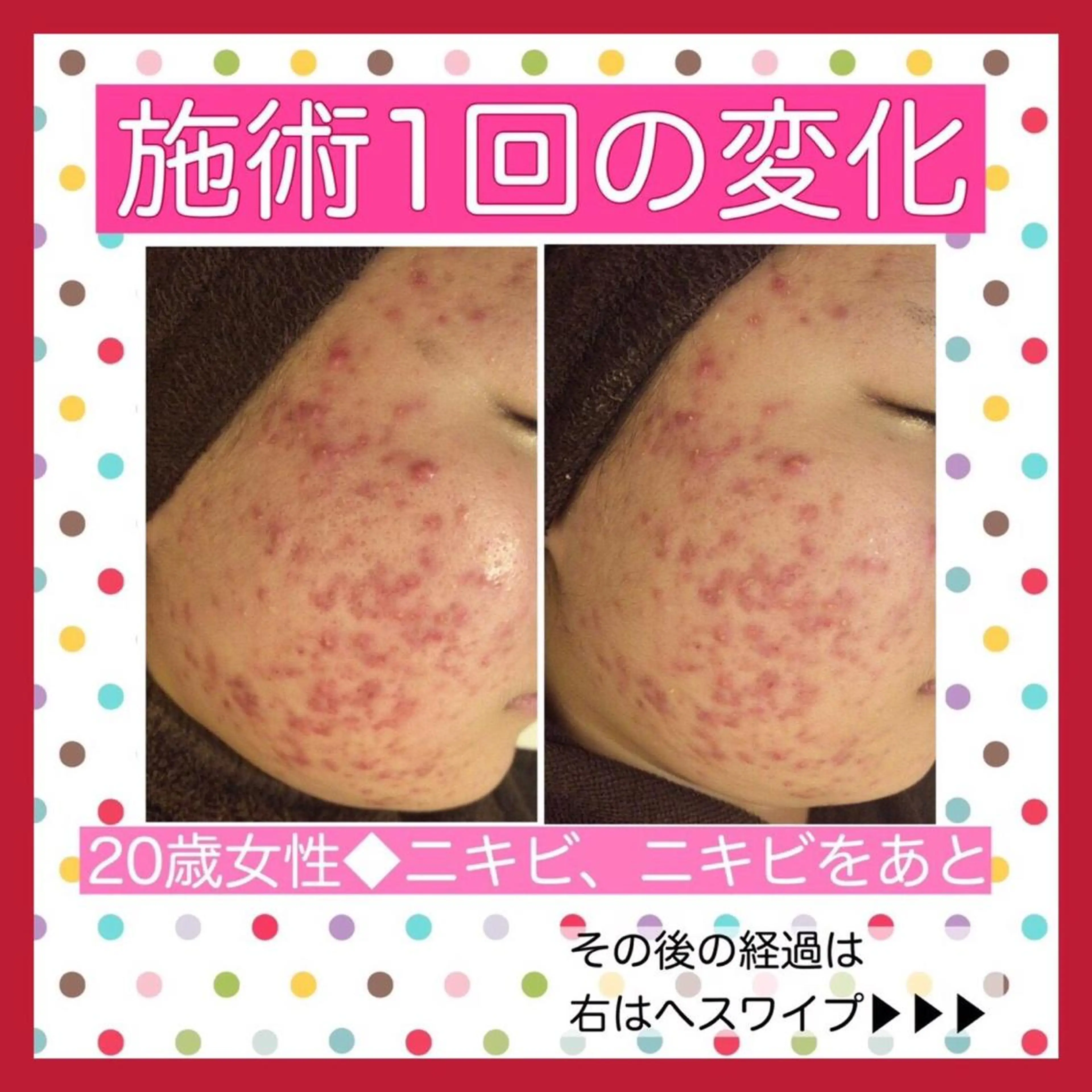 ミディアム カラー パーマ ヘアアレンジ メンズ キッズ ネイル マツエク・マツパ ニキビ・肌質改善専門 ♡人生が変わるサロンのエステ・リラクイメージ